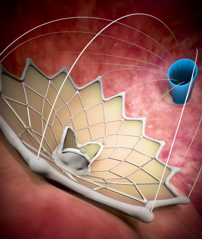 animations and videos — are crucial tools for educational and marketing purposes. Learn how medical animation can help your business.