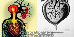 AI generated image of a human heart in the style of Charles Schulz