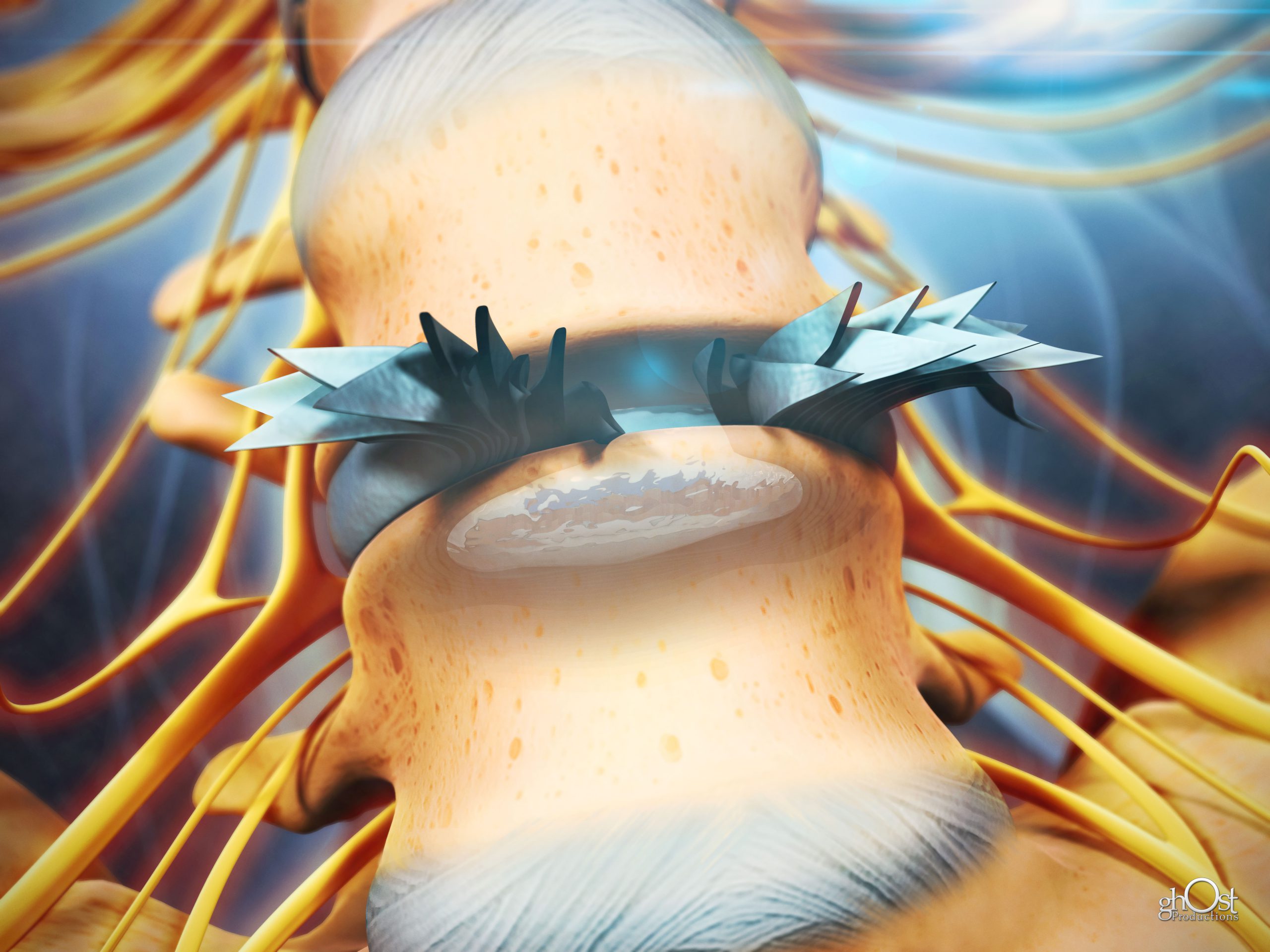 Case Study: Veritas Health – Herniated Disc Pilot Animation