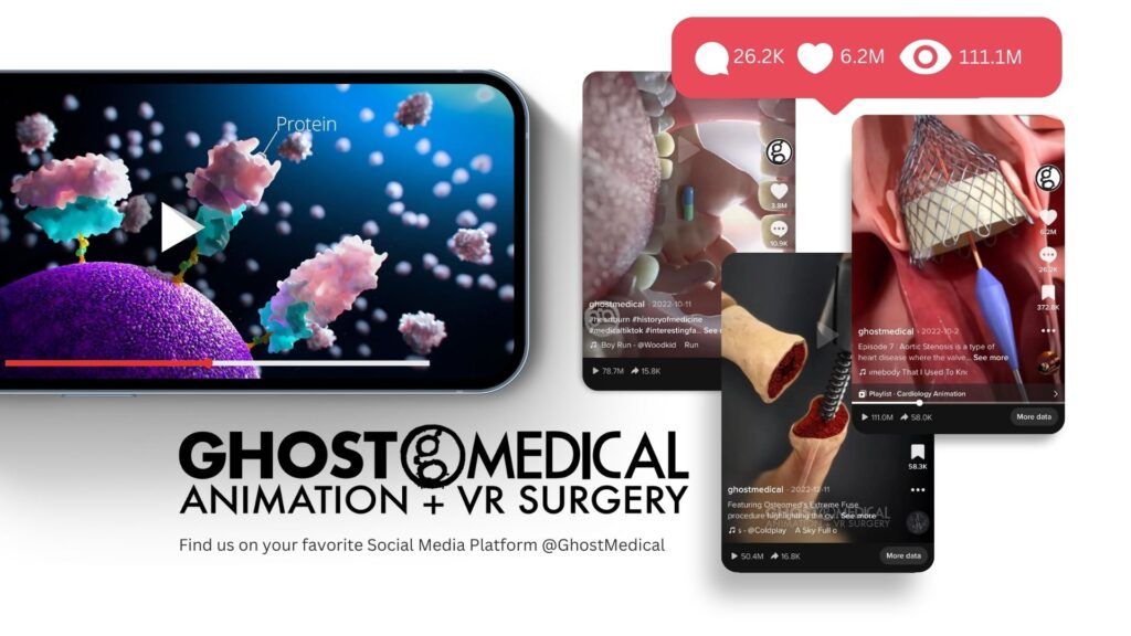 Ghost Medical Animation + VR Surgery Studio gained over 1 Million Organic Followers over the course of a few months using medical content. 