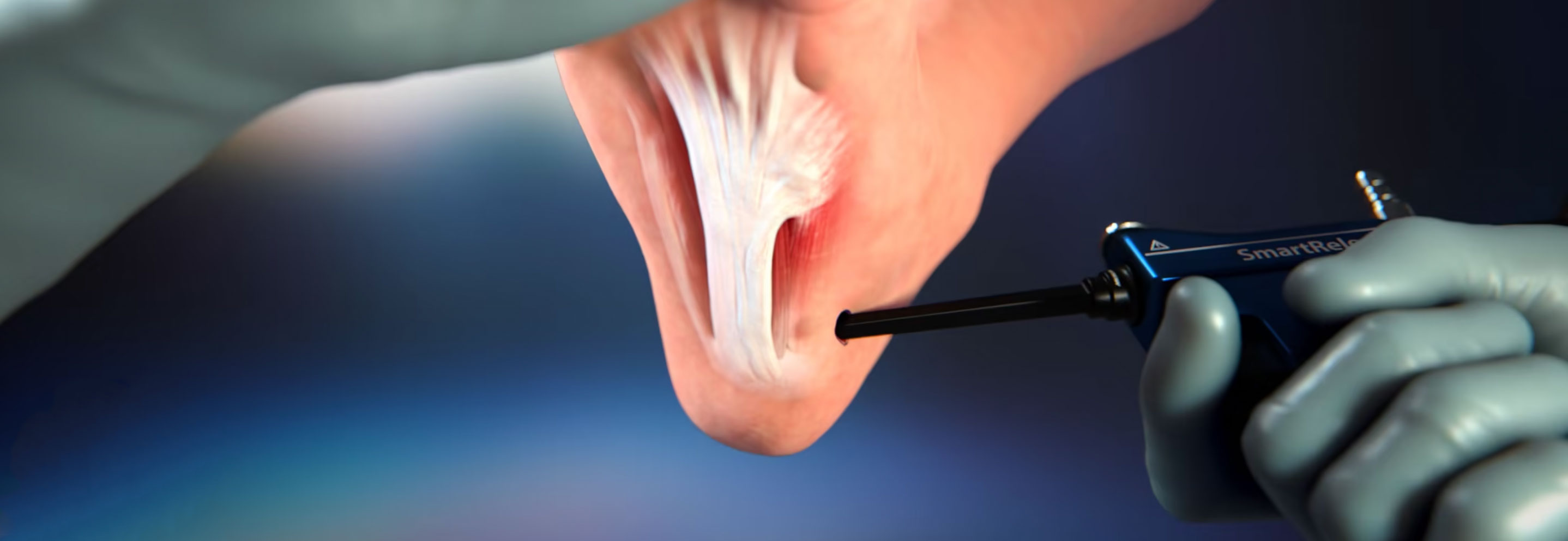 The Transformation Of Healthcare Through 3D Medical Animations