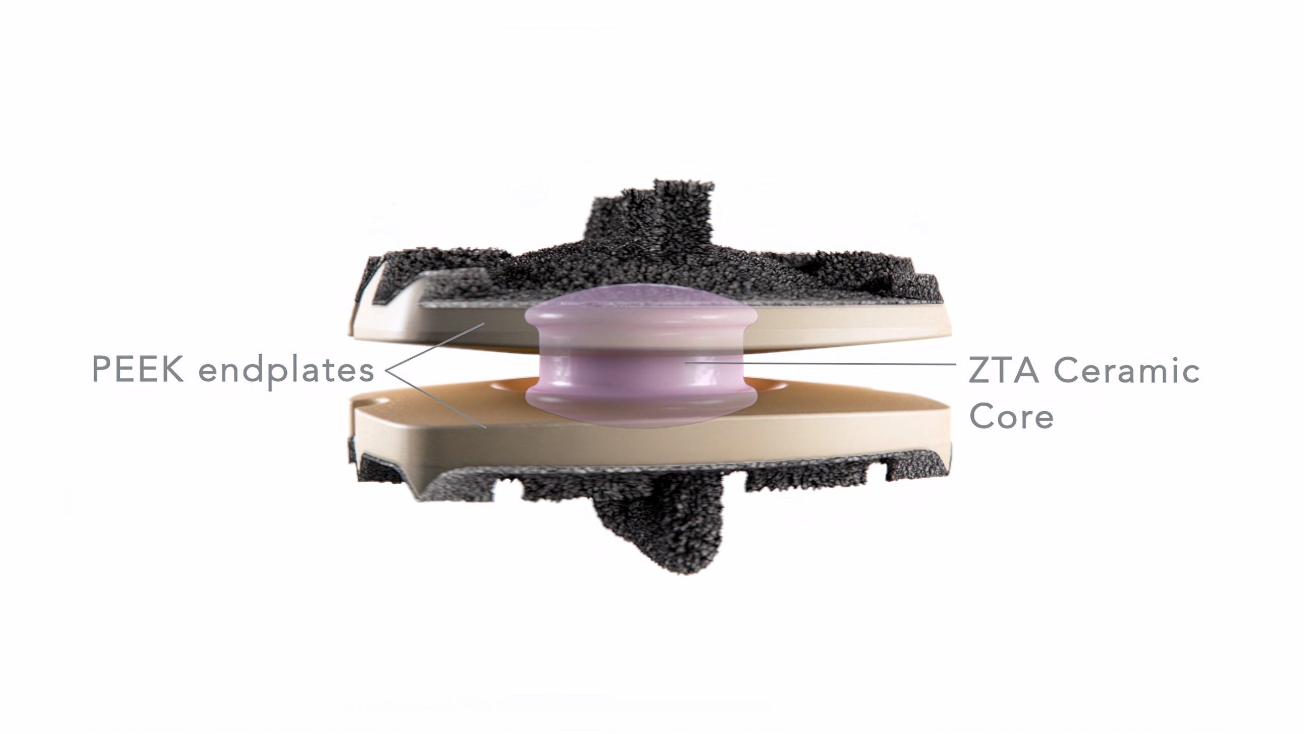 Ghost Medical - NuVasive - Simplify Disc Animation