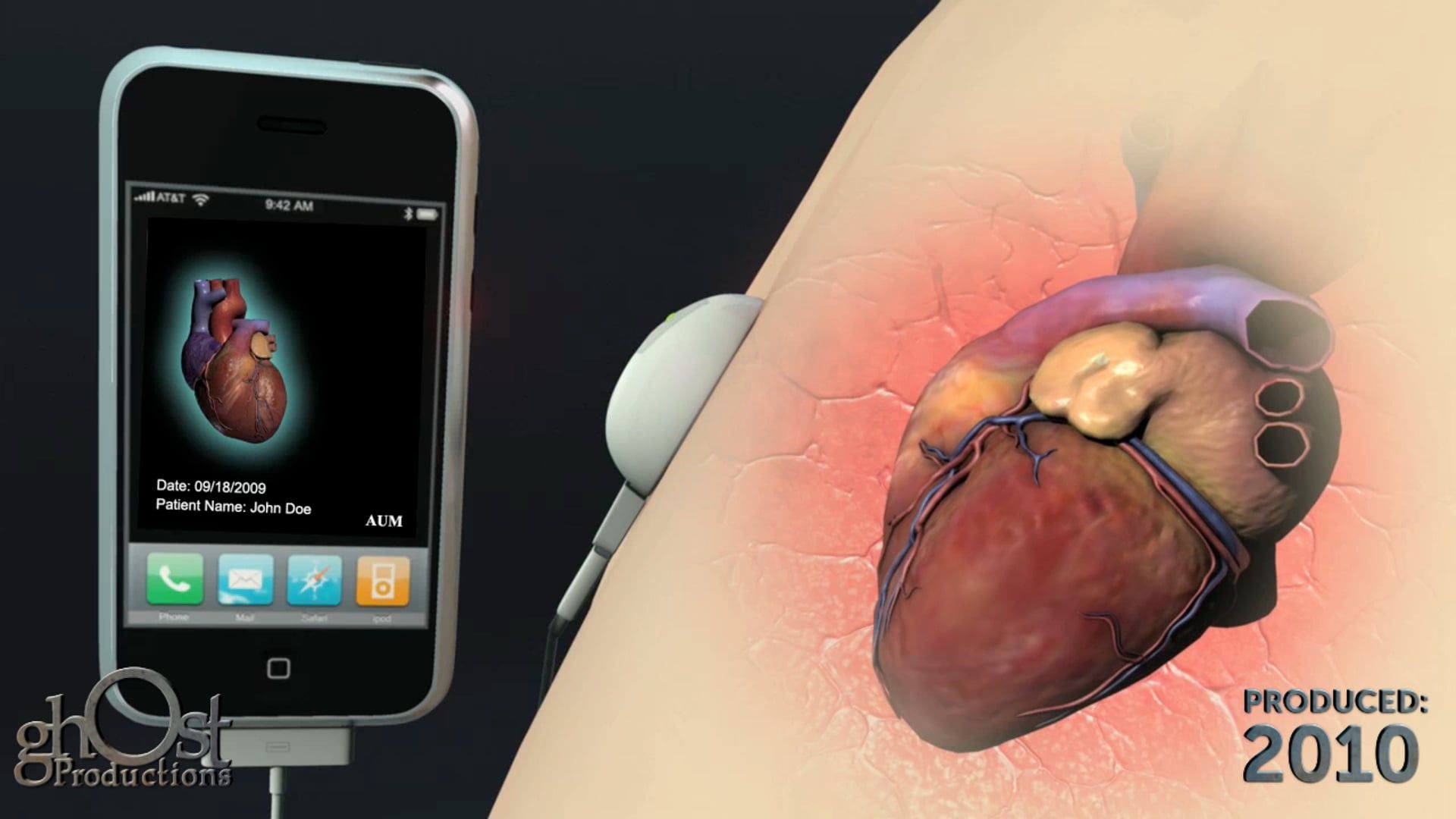 heart health, AUM Cardiovascular, technology, technique animation, Ghost Productions, innovative concept, phone, cardiovascular wellness, healthcare professional, heart health monitoring, revolutionary, cutting-edge technology, future of heart health monitoring