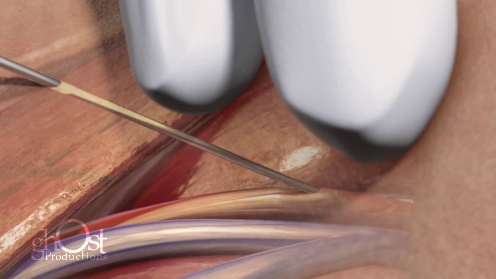 cardio animation, heart, circulatory system, blood flow, cardiovascular health, medical professionals, patient education, human body, medically accurate, engaging visuals, easy-to-understand explanations, valuable resource, understanding, cardiovascular system.