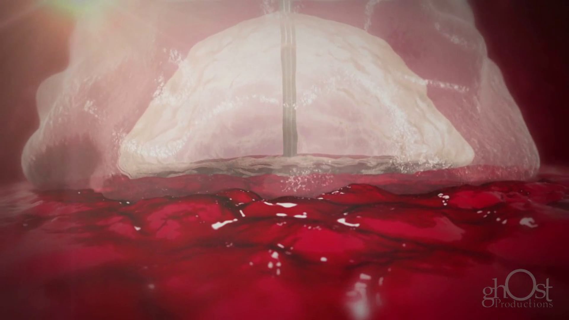 Ghost Productions, medical animation, MynxGrip Access Closure device, arterial access sites, minimally invasive procedures, patient safety, healthcare professionals, interventional cardiology, physician, nurse, healthcare provider, reliable hemostasis, reduced risk of complications, innovative product, visually stunning, medically accurate, key features, benefits, ease of use.