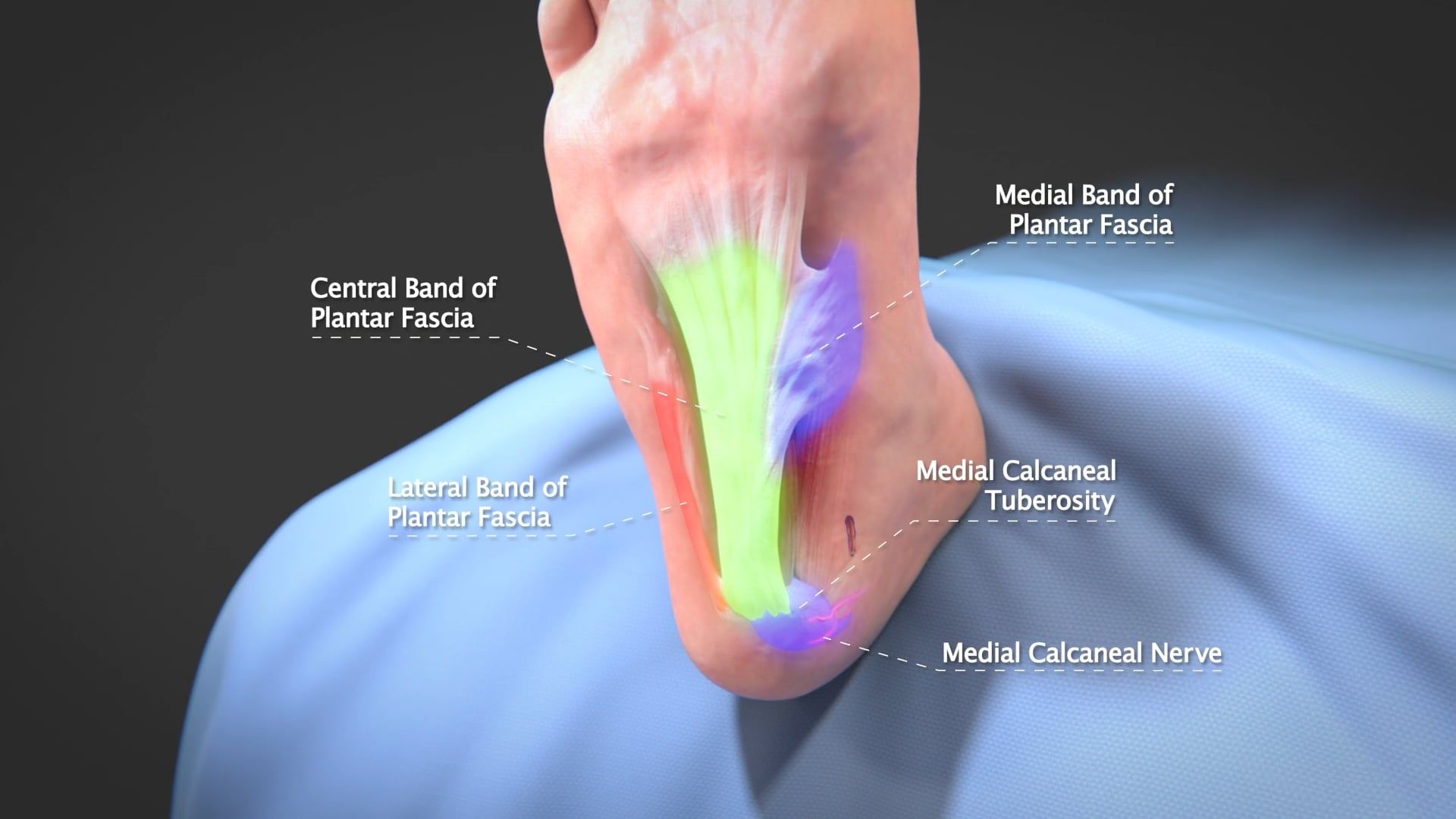 MicroAire Surgical, Ghost Productions, SmartRelease, surgical tool, transecting, transverse carpal ligament, fascia, cubital tunnel, recession, plantar fascia, gastrocnemius aponeurosis, animation, procedure, cutting, ligament, tension, inflammation, plantar fasciitis, endoscope, handpiece, disposable blade assembly, video camera, light source, medical professionals, patients, usage, surgery, resource, medical devices, pharmaceutical products, Ghost Productions Medical Animation Studio, Surgical VR Developer.