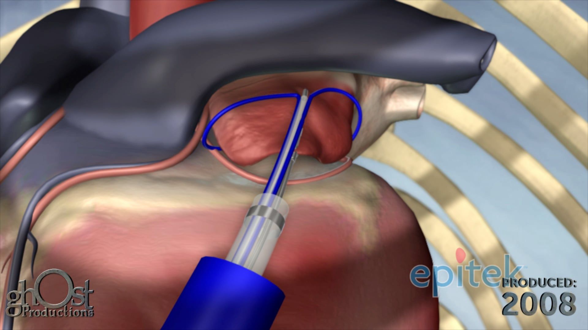 Ghost Medical Presents: Epitek Anchorage