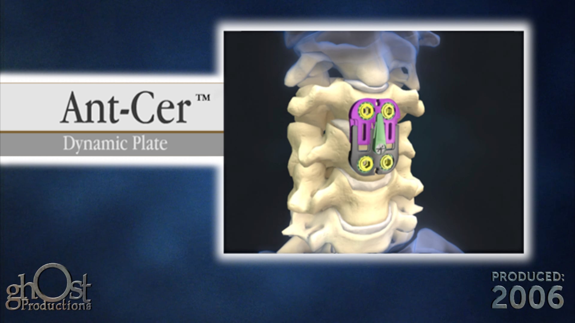 Abbott Ant-Cer™: The Revolutionary Medical Solution by Ghost Medical