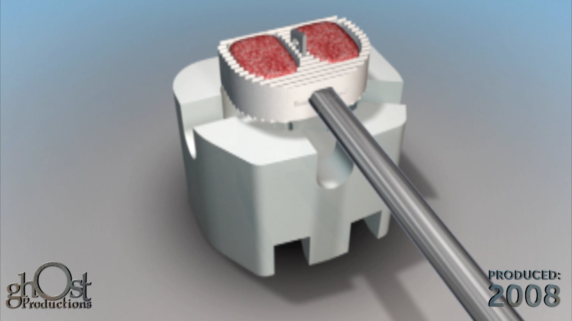 Ghost Medical presents: Abbott Fidji