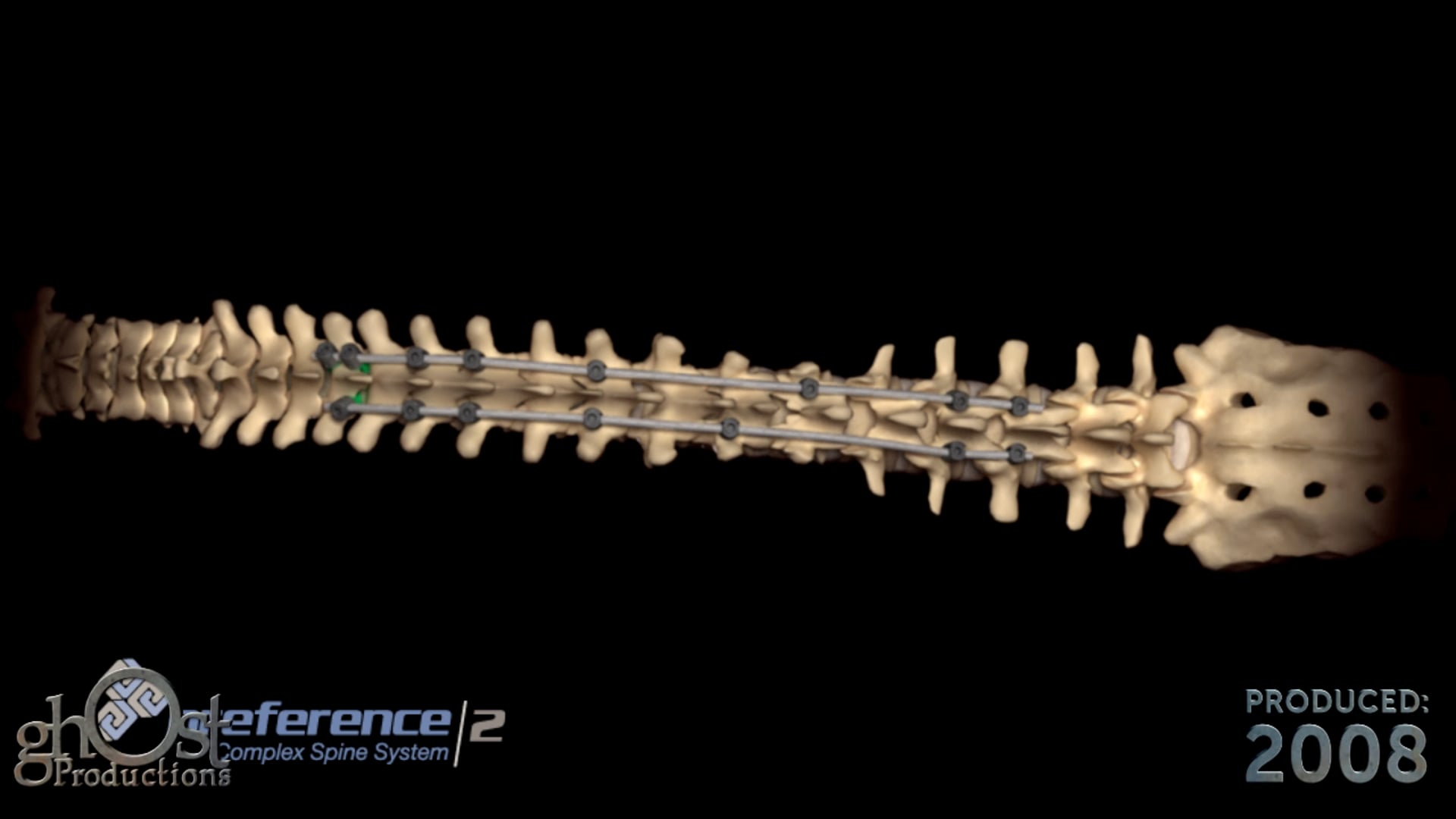 Ghost Medical's US Spine PreferenceCS Animation