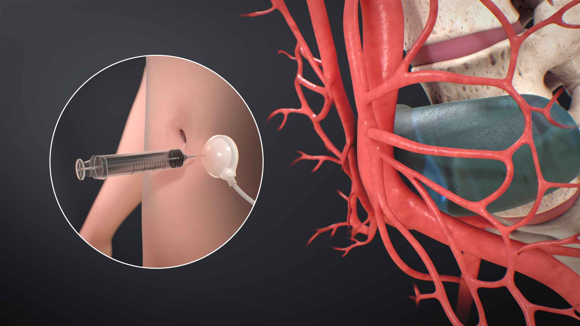 Healthcare Marketing