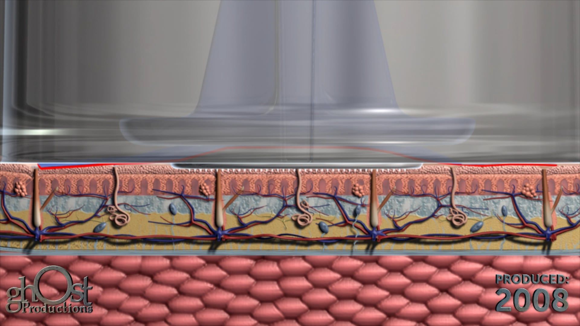 Ghost Medical Presents: MTS Injection Animation