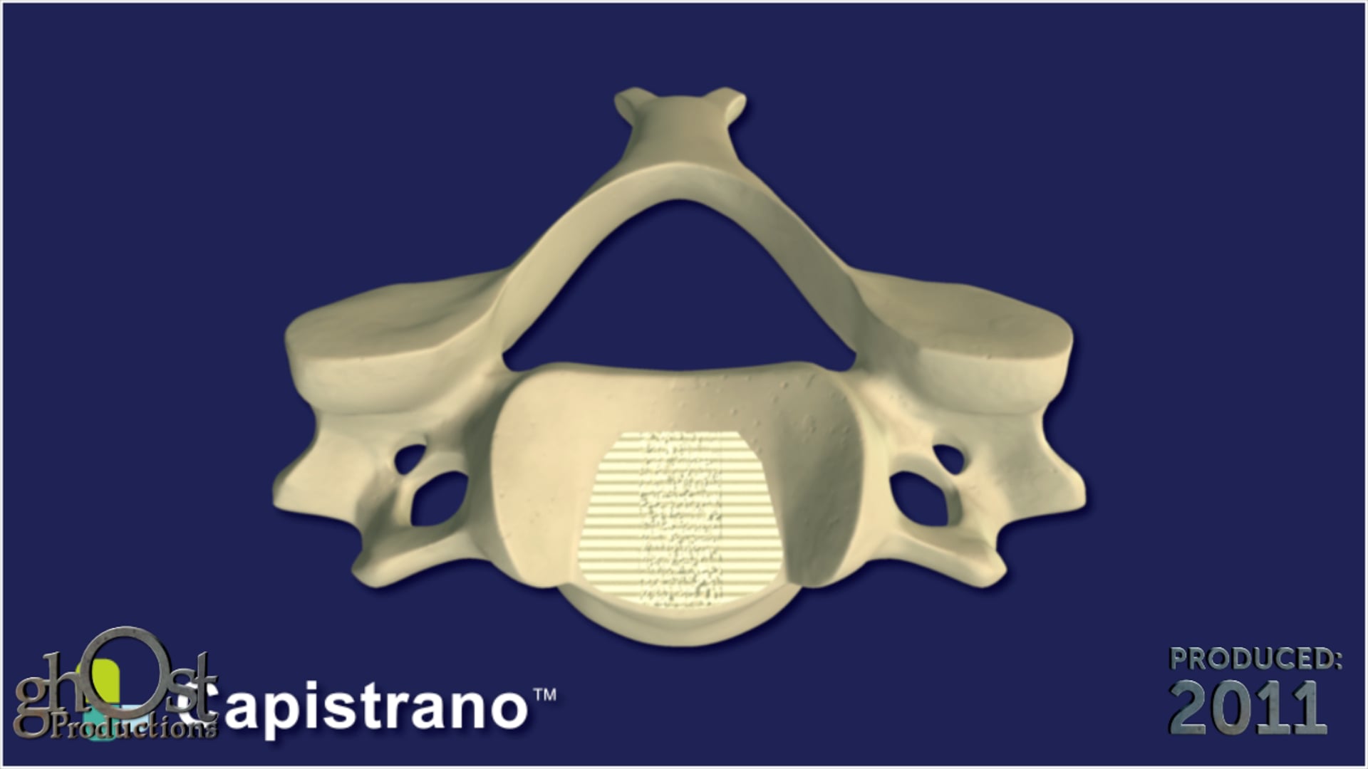 SeaSpine, Capistrano system, cervical spacer system, cortical allograft bone, cancellous allograft bone, structural solution, osteoconductive solution, Ghost Productions, animation, medical product, unique features, benefits, valuable tool, medical professionals, patients, clear representation, accurate representation, Capistrano system capabilities, cervical spine surgery, crucial advancement, orthopedic medicine, essential resource, potential impact.
