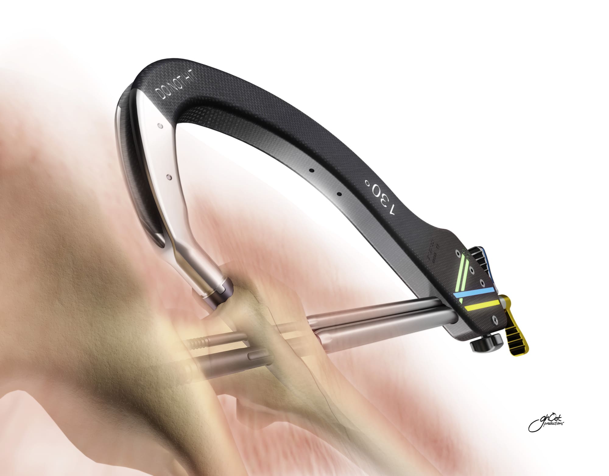 Venture Capital Investments in MedTech Create a Boon in First Quarter of 2014