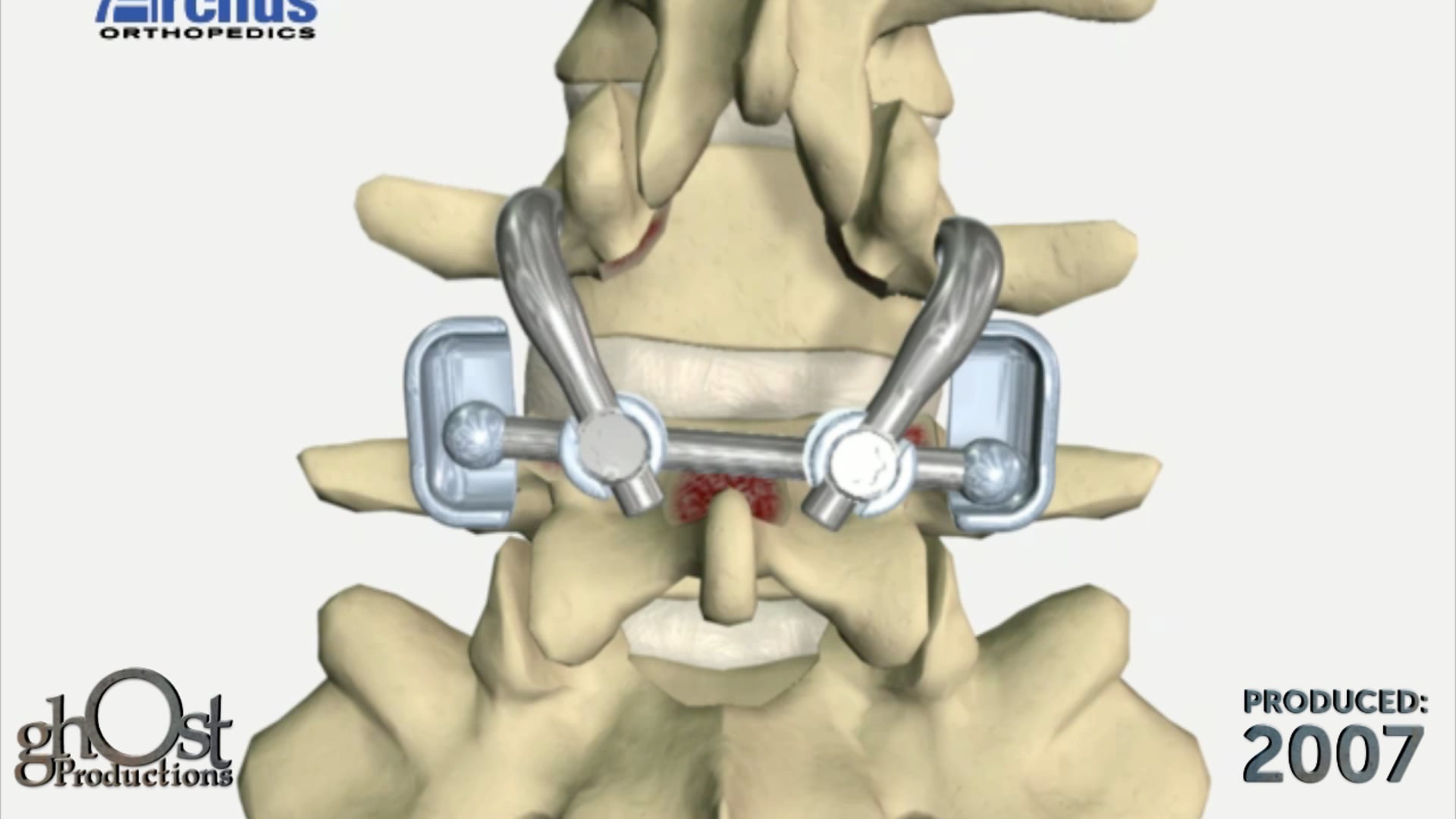 Ghost Medical Presents: Archus TFAS Animation