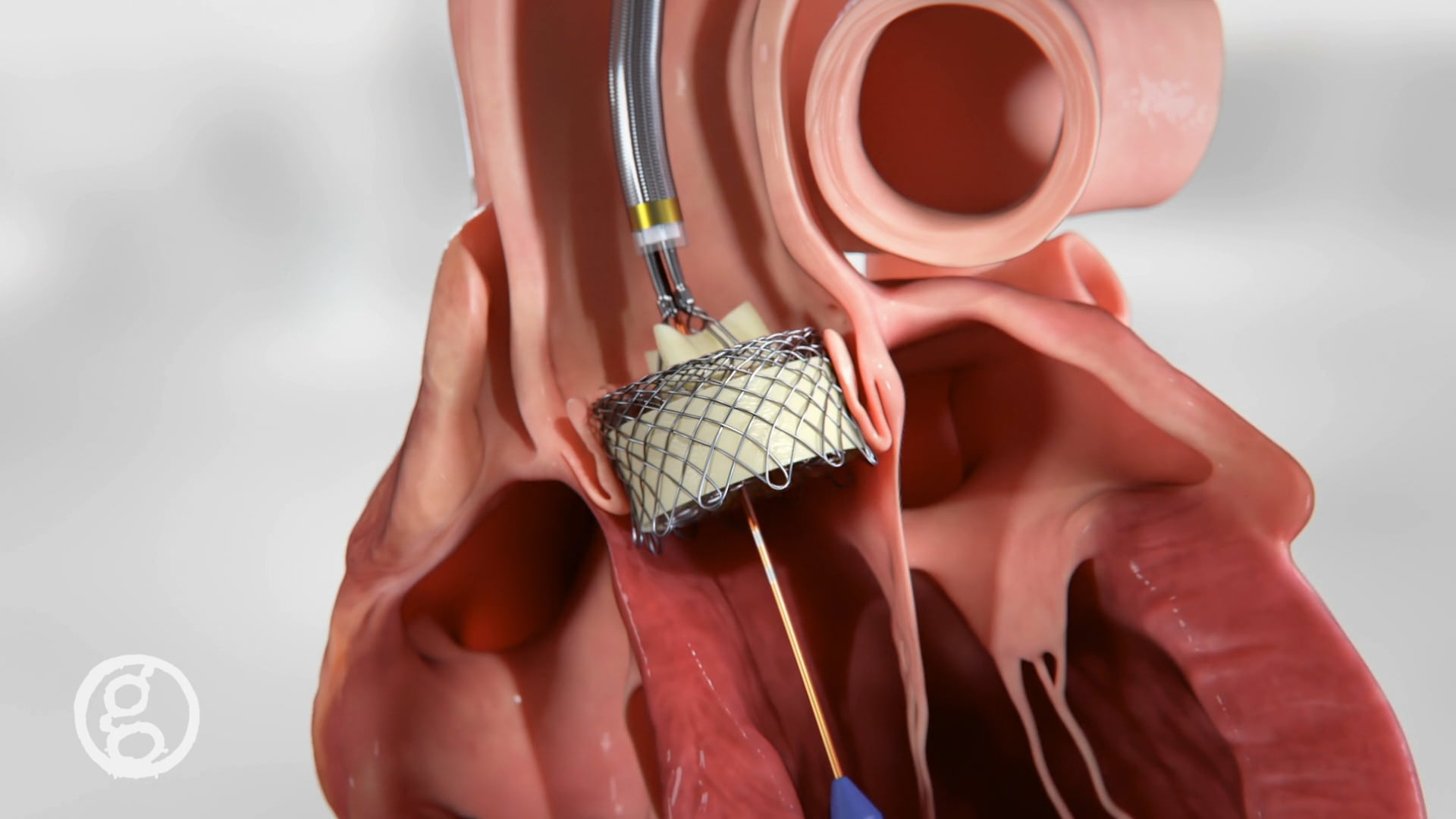 Medical Animation: 2020 Animation Demo - Ghost Productions | Video