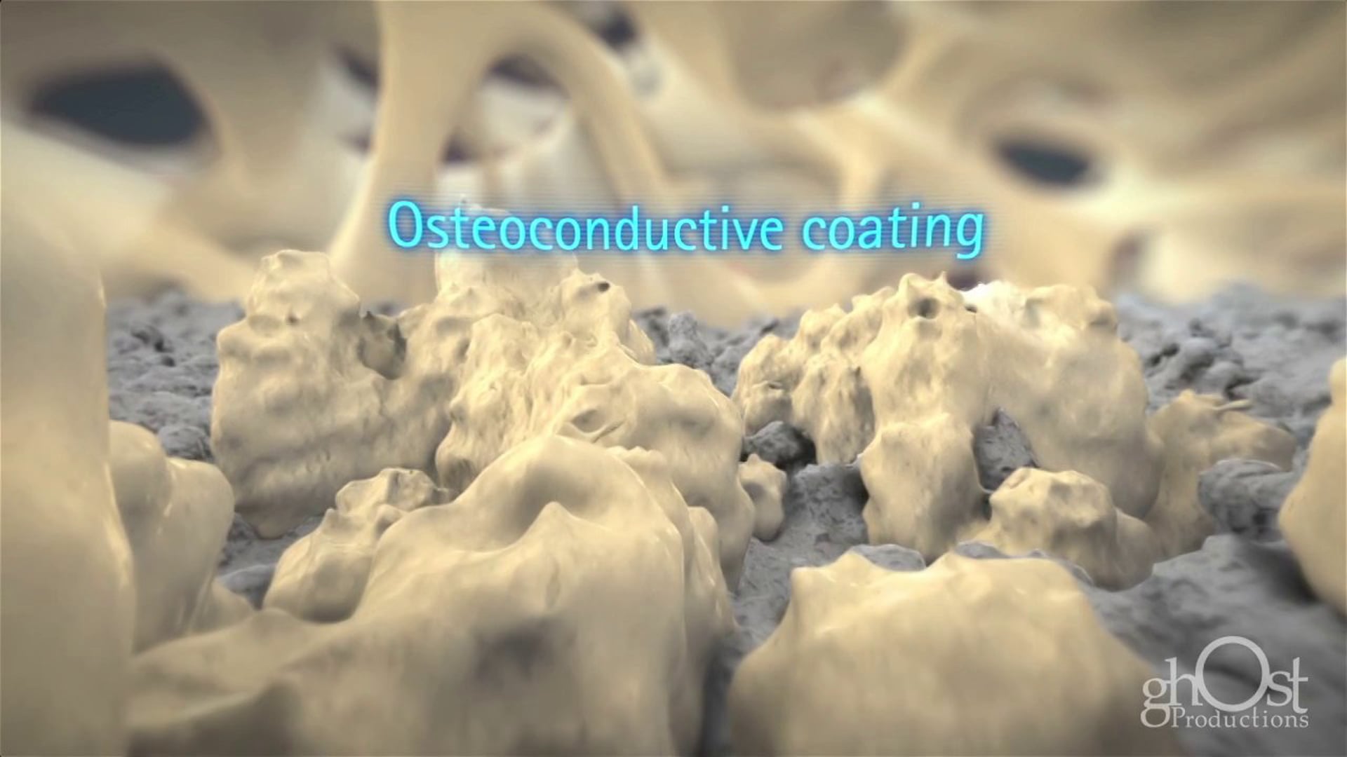Osteoconductive coating, Plasmapore, bone growth, regeneration, orthopedic surgeries, bone-related injuries, medical professionals, patients, cutting-edge product, orthopedic medicine.