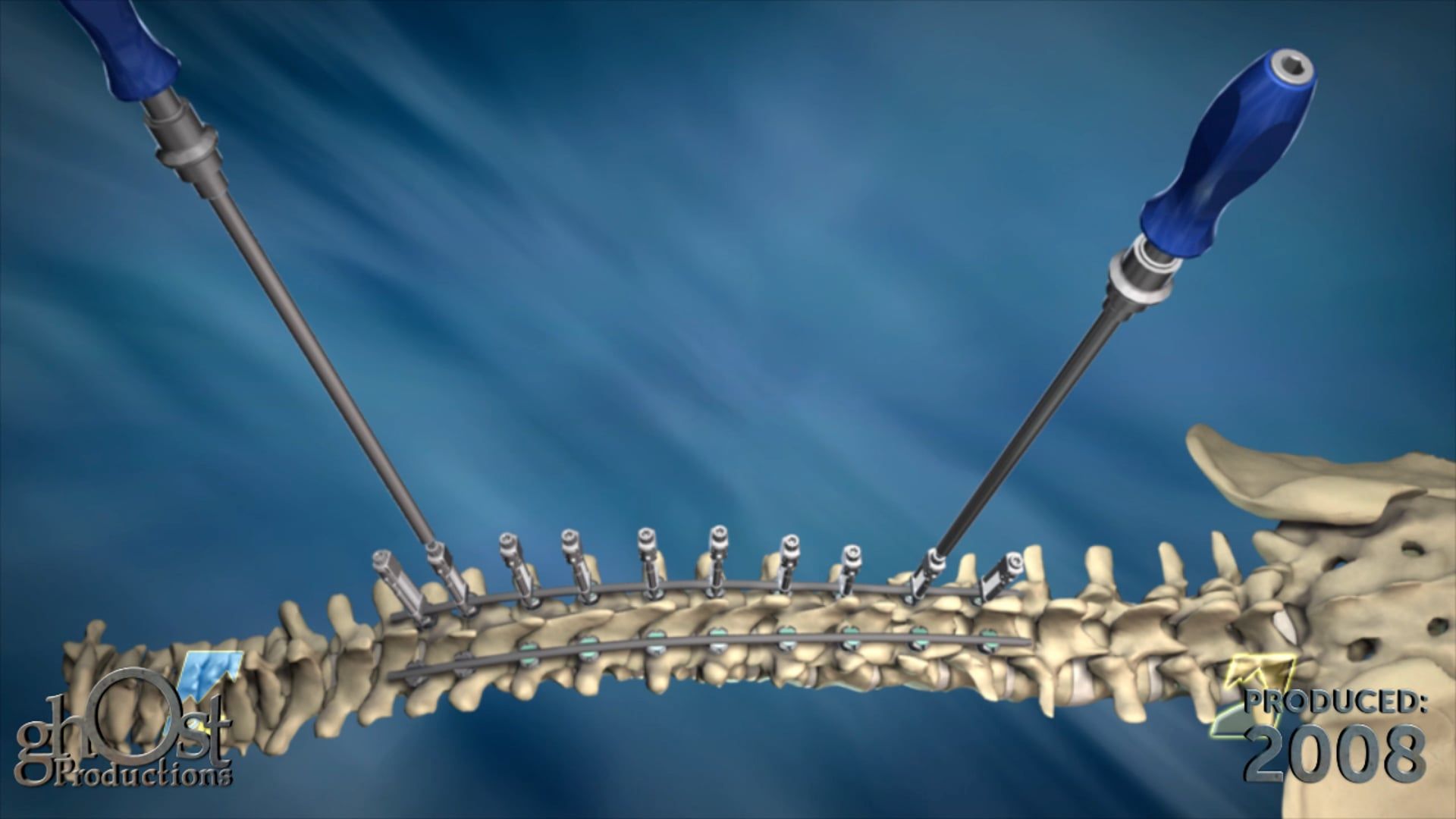 Ghost Medical Presents: The K2M RangeSingle Animation