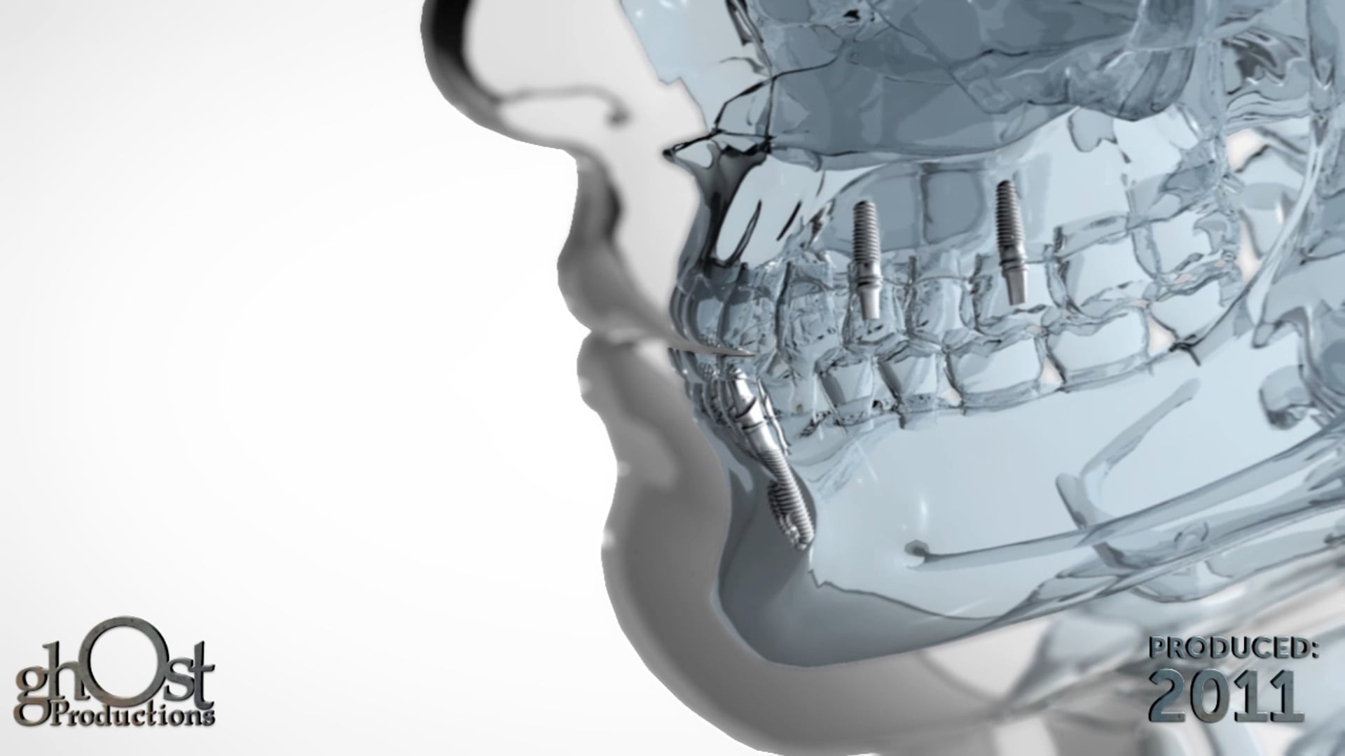 Ghost Medical's Dental Animation: A Comprehensive Guide to Oral Health