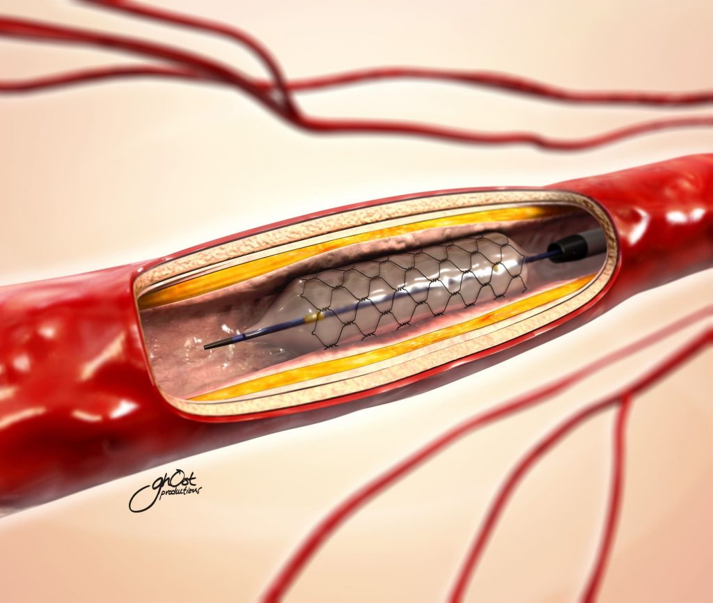 Case Studies | Blog Search