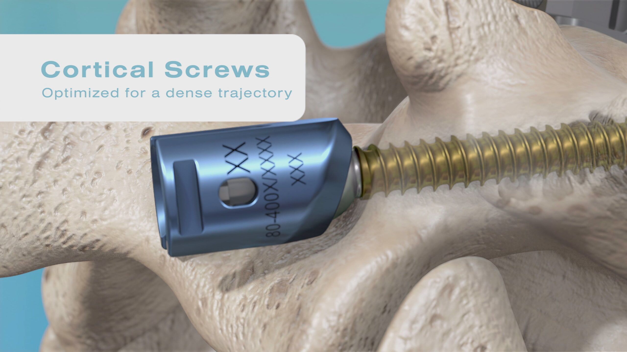 FacetLINK platform, less invasive lumbar surgery, surgeon's preferred decompression exposure, innovative product, game-changer in orthopedic surgery, safer and more efficient alternative, faster recovery time, reduced risk of complications, minimally invasive approach.