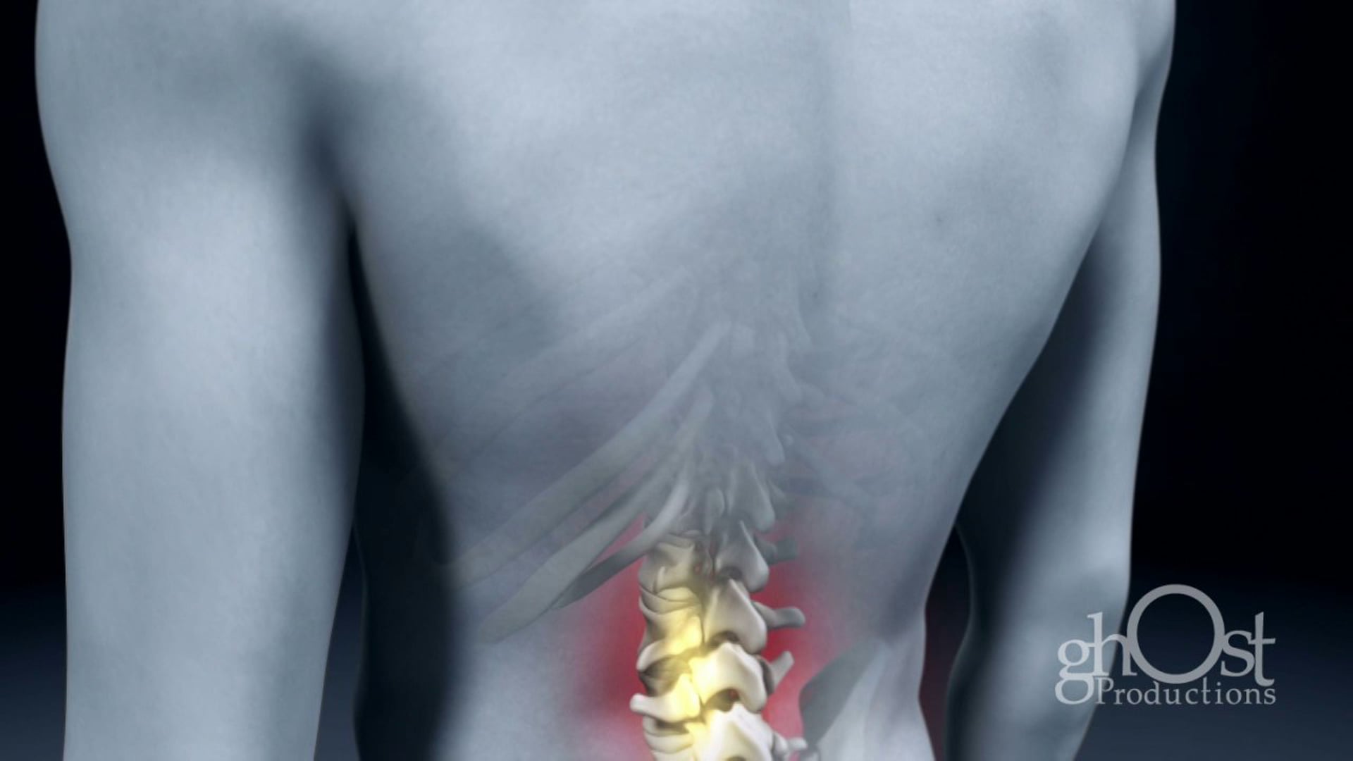 Ghost Medical - John Lymberg Productions - Orthaheel - HD