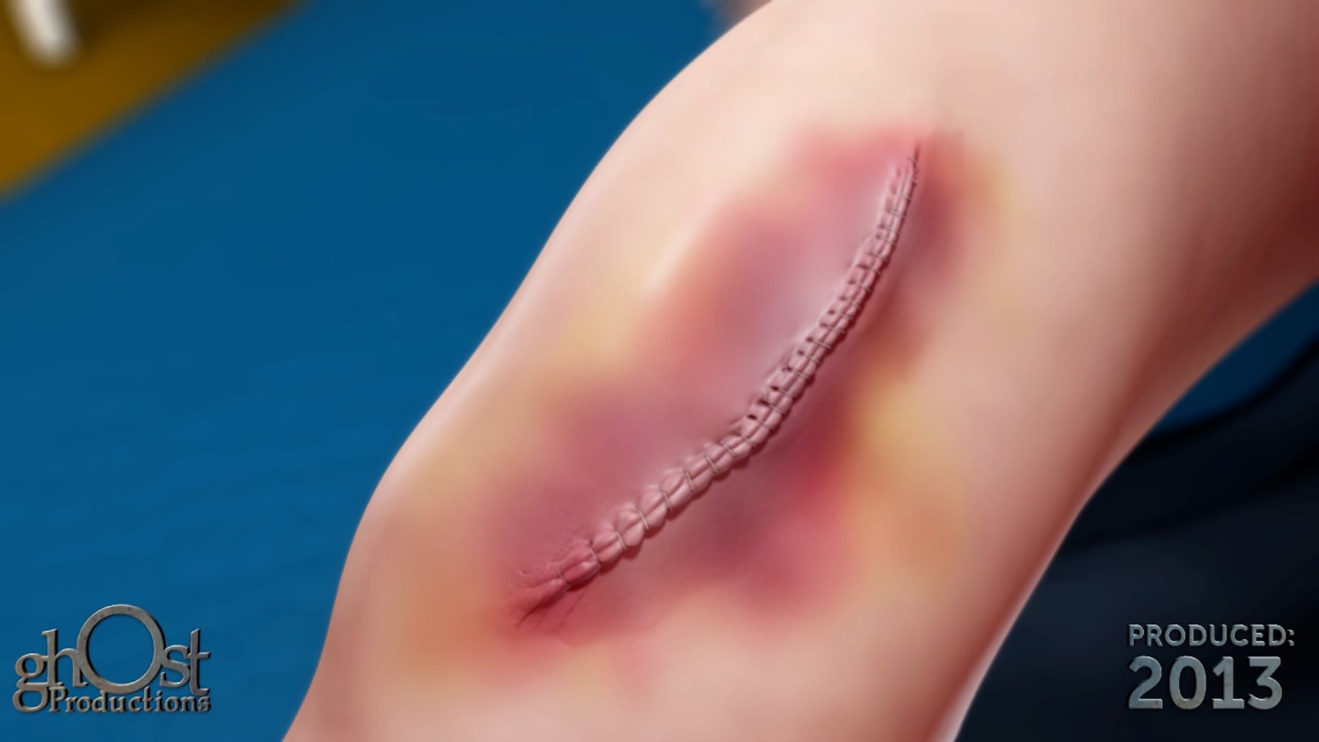 Medtronic, Aquamantys, medical device, surgical procedures, precision, control, electrocautery, Ghost Productions, animation, surgeon, medical professional, medical technology, surgical innovation.