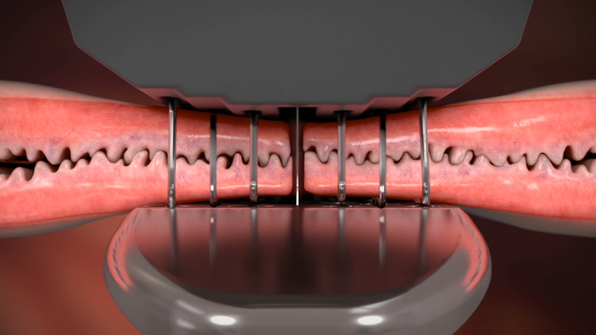 medical animation, Ghost Productions, Medtronic, TriStaple, surgical procedures, leak resistance, tension, Curved Tip pivoting anvil reloads, fixed anvil reloads, stepped cartridge face, varied height staples, medical devices, pharmaceutical products, virtual reality services.