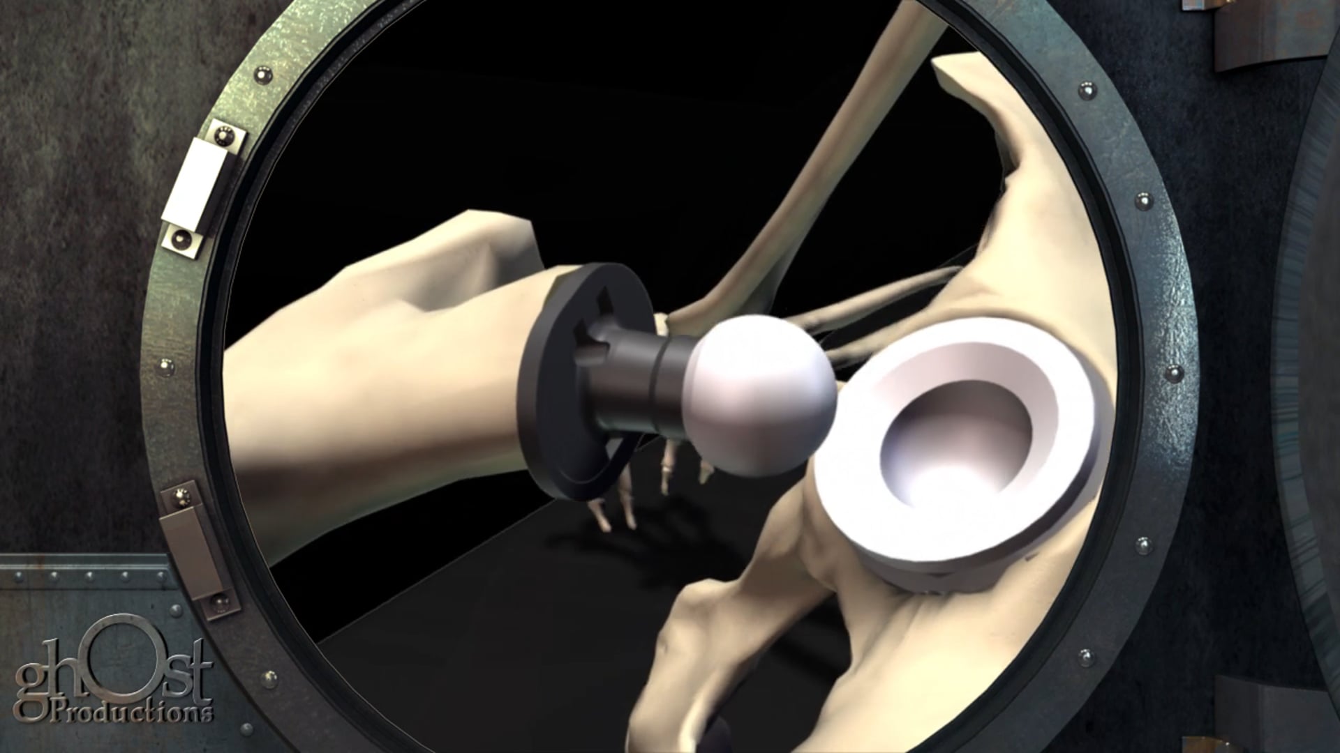 hip replacement procedure, medical animation, surgical process, generic implants, key steps, complex procedure, medical techniques, hip replacement surgery, medical accuracy, resource, medical clients, SEO