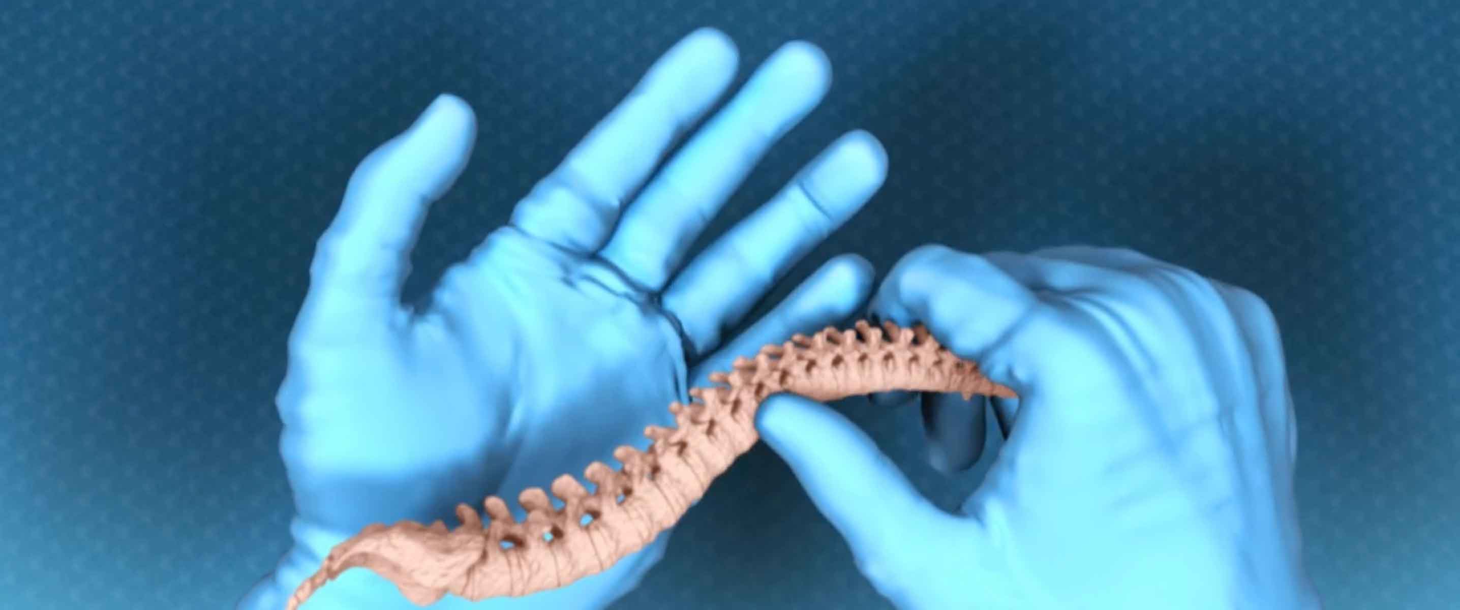 Medical Animation Case Study: Orthofix Trinity Elite