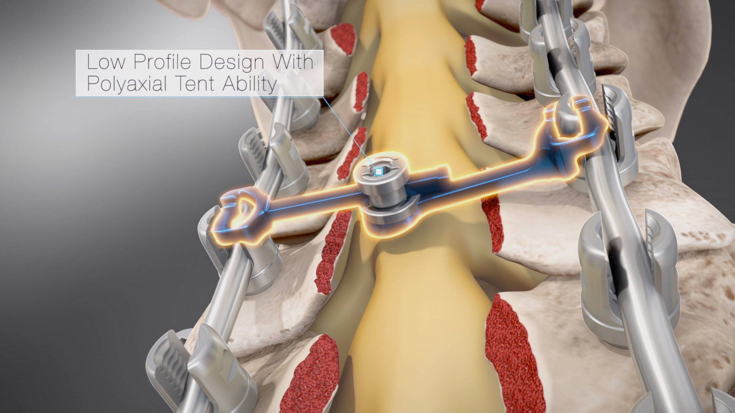 Ghost Medical - Spine Wave Animation - Expertly Crafted