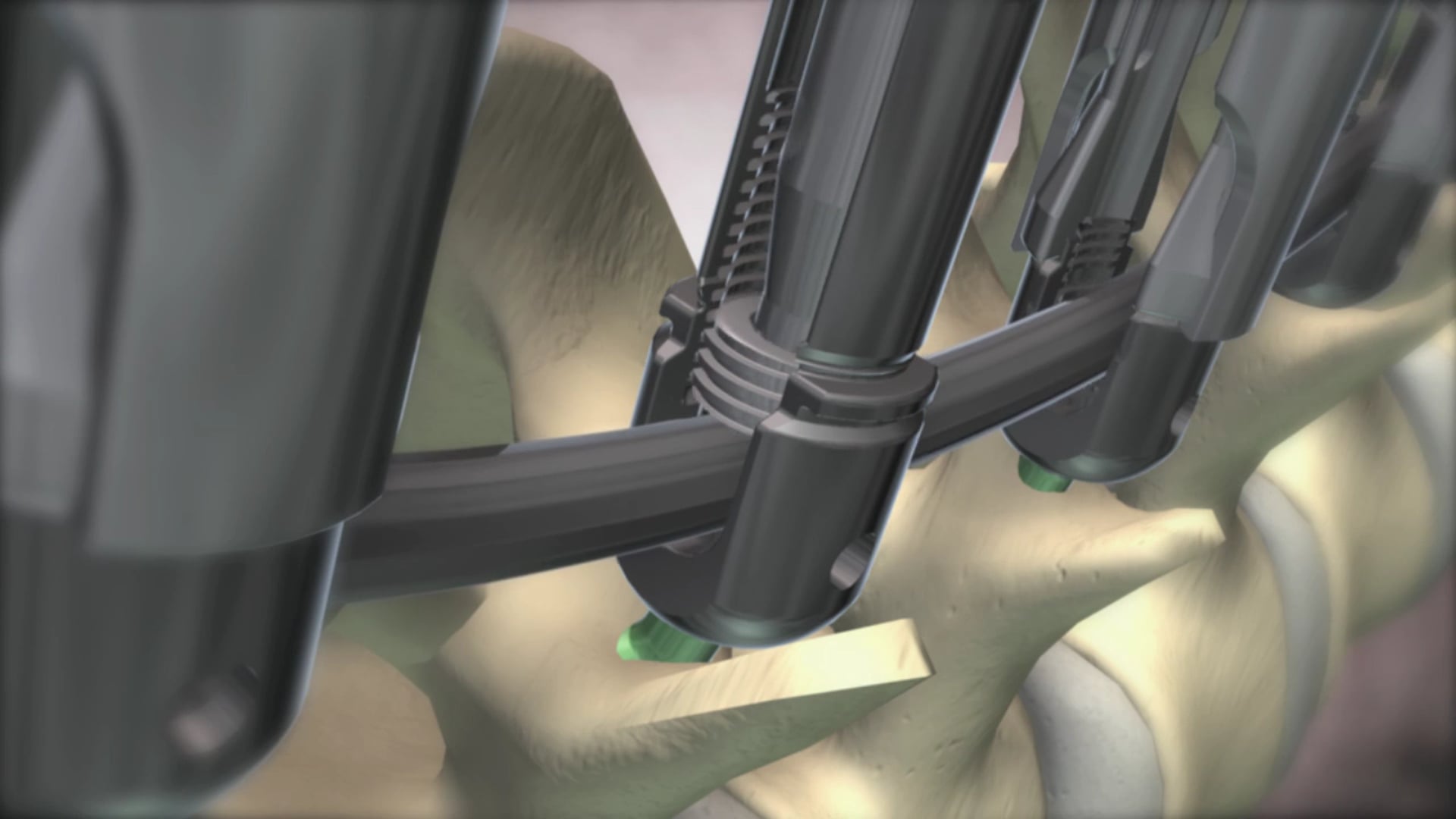 Ghost Productions, medical animation, spine animation, spine surgery, NASS conference, K2M, Medtronic, SeaSpine, TranS1, Abbot Spine, DePuy, Spineology, anatomy of the spine, innovative products, patient outcomes, medical professionals, researchers.