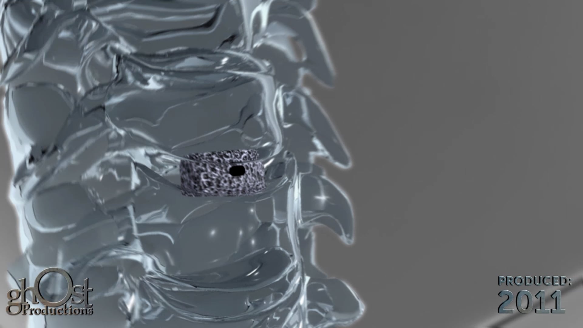 Ghost Productions, medical animation, transparent spine, cervical interbody spacer, pedicle screw fixation, lumbar region, surgical procedures, spinal conditions, orthopedics, neurosurgery, interbody spacers, high-quality, informative, engaging, advancements, spinal surgery, treatment.
