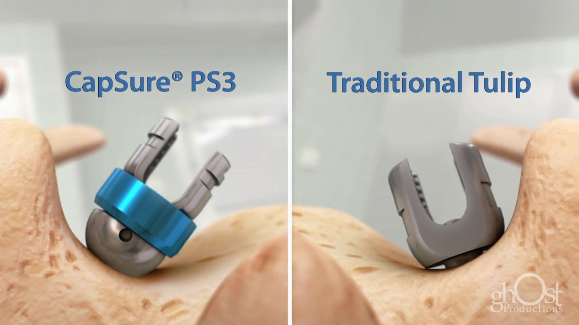 Ghost Medical Presents: SpineWave - Capsure Animation