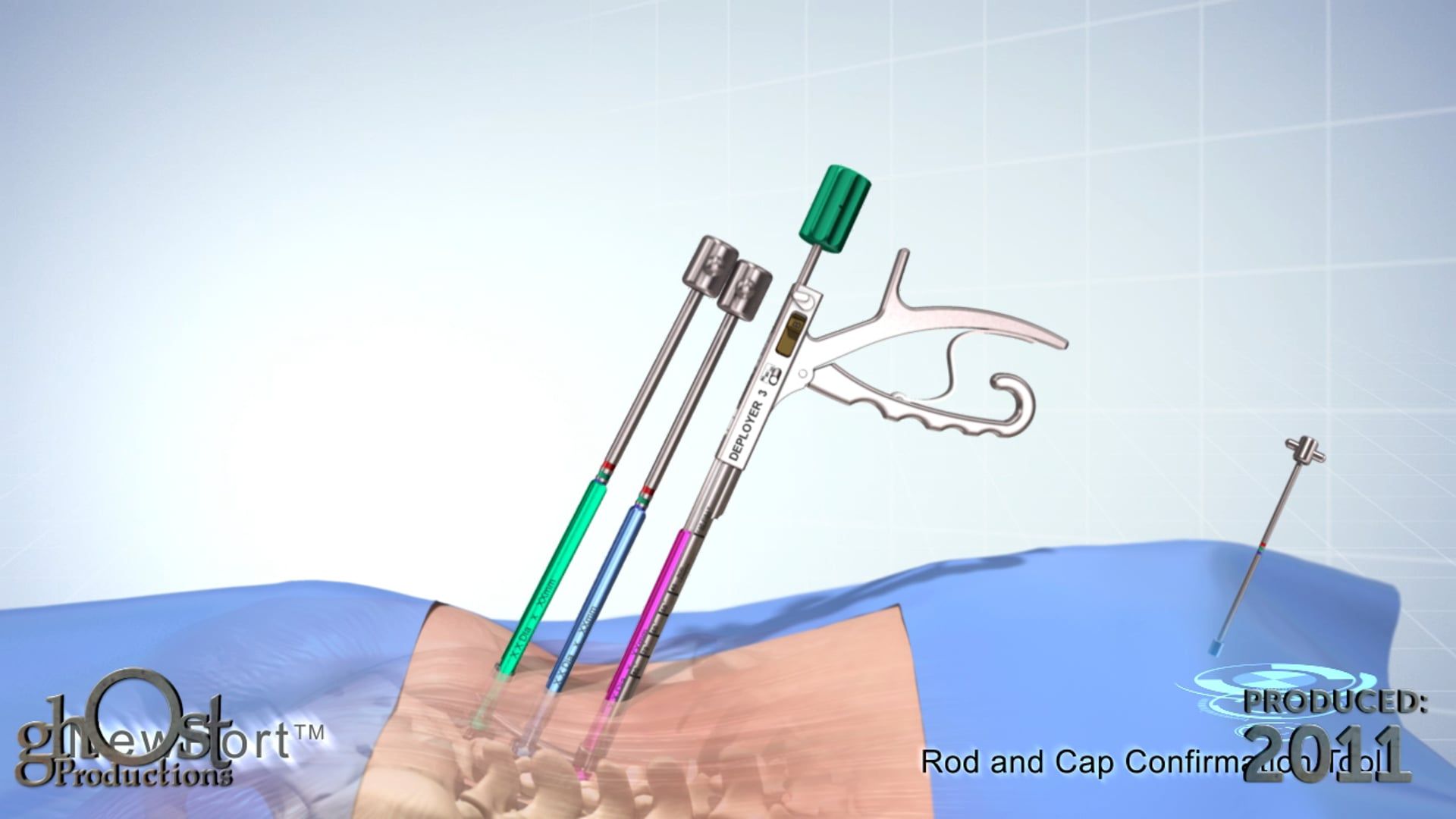 SeaSpine, NewPort system, MIS posterior fixation system, Ghost Productions, user-friendly, intuitive, low profile, extended-tab screws, smaller incisions, animation, advanced features, revolutionize, spinal surgery, minimally invasive techniques, game-changer, orthopedic medicine.