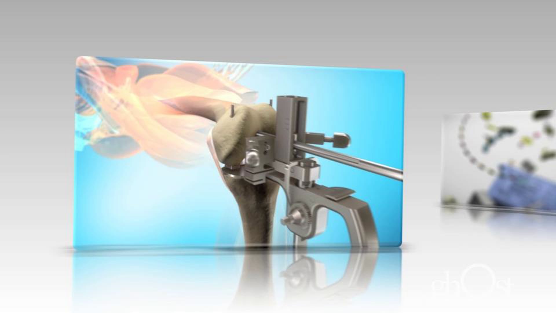Ghost Productions, medical animation, orthopedic medicine, animation showcase, medical accuracy, orthopedic procedures, product effectiveness, treating orthopedic conditions, precision, attention to detail, captivate, educate, medical professionals, patients, commitment to excellence, visually stunning, informative content.