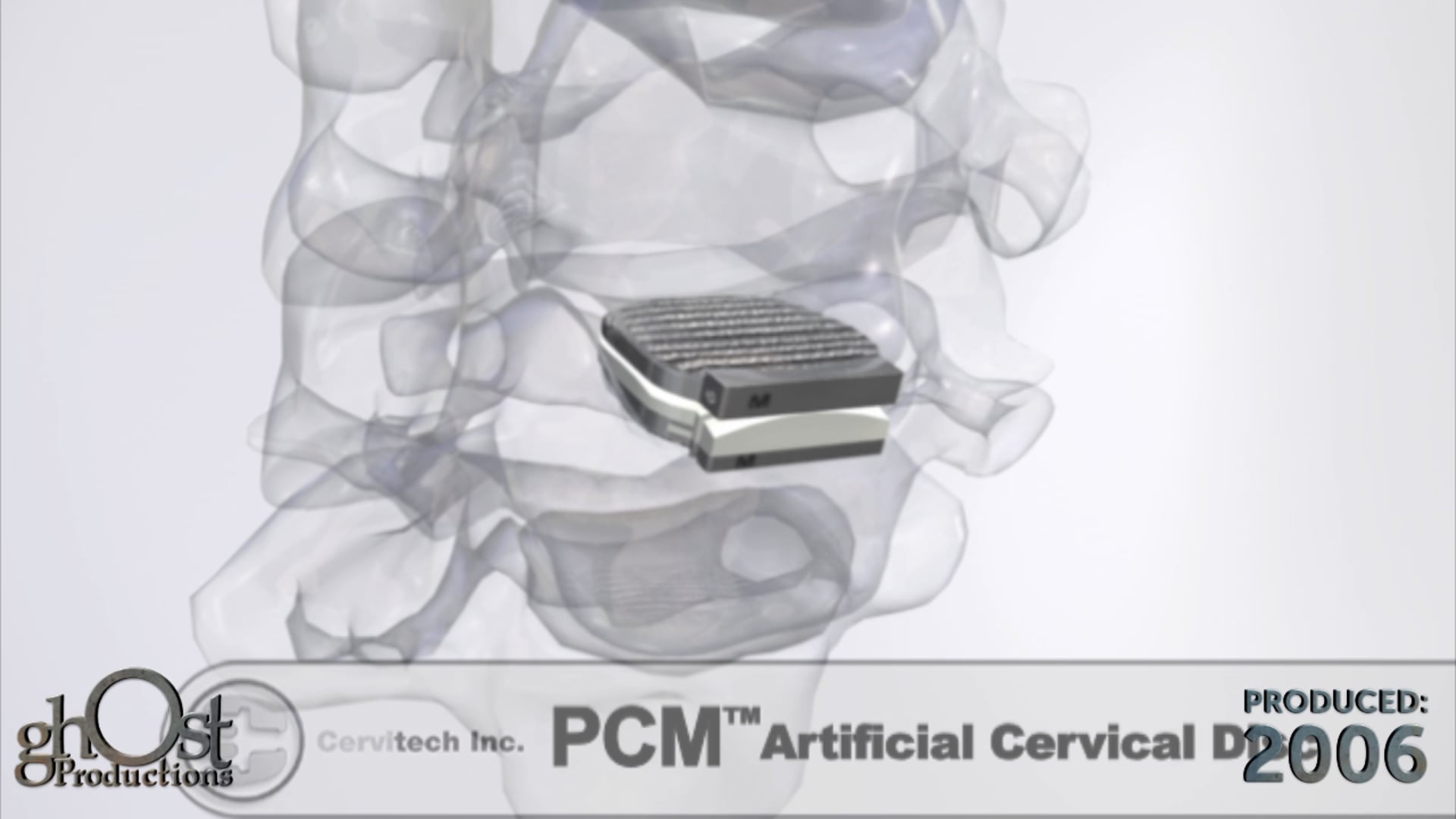 Ghost Medical Presents: Cervitech PCM Animation