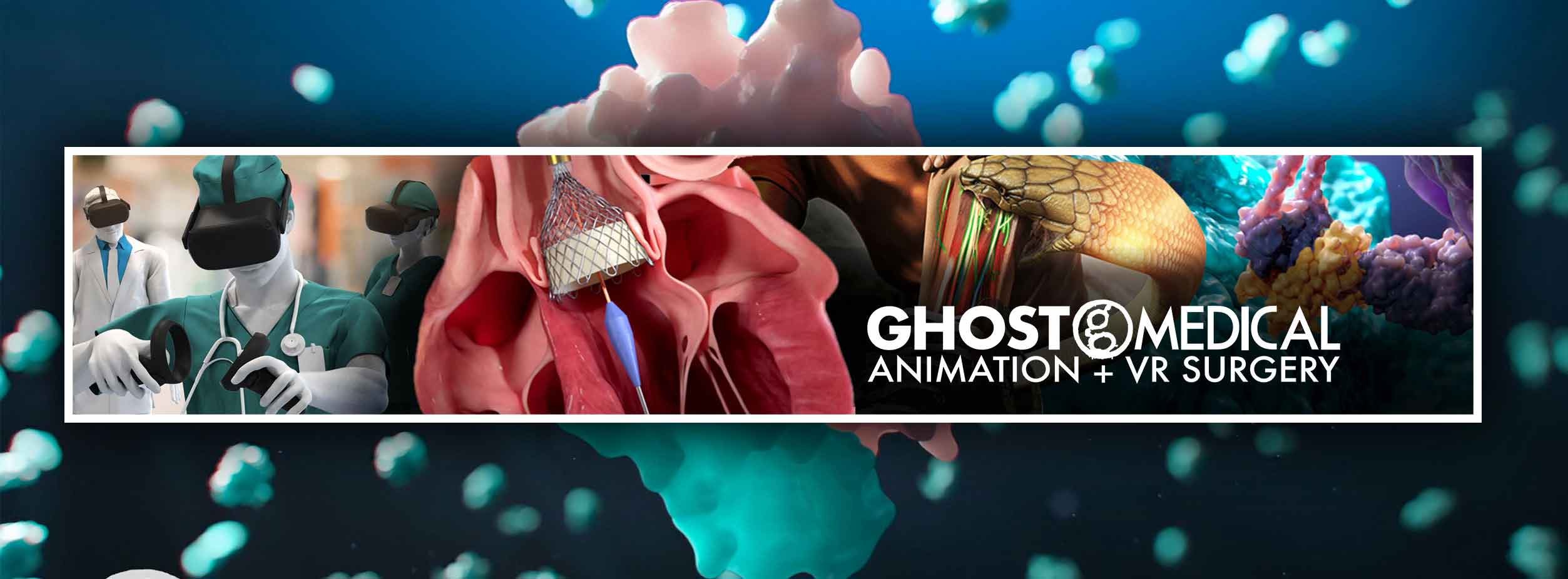 5 Reasons to Choose Ghost Medical for Your Medical Animation and Visualization Needs