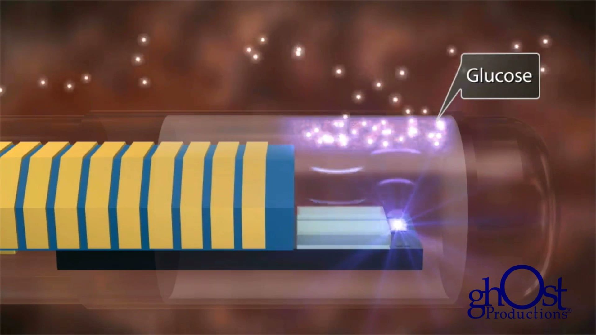 Ghost Medical's 2D Revision for Senseonics