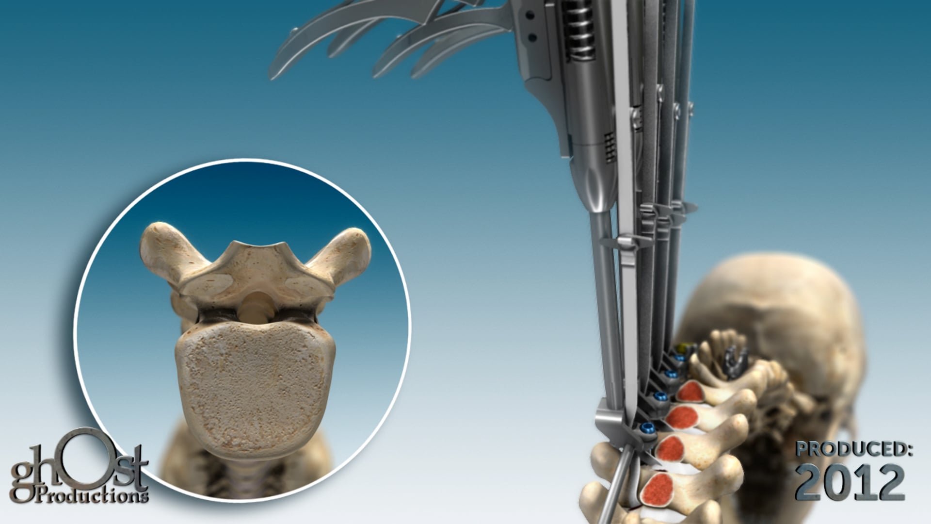 Ghost Medical Presents: The Zimmer Universal Clamp