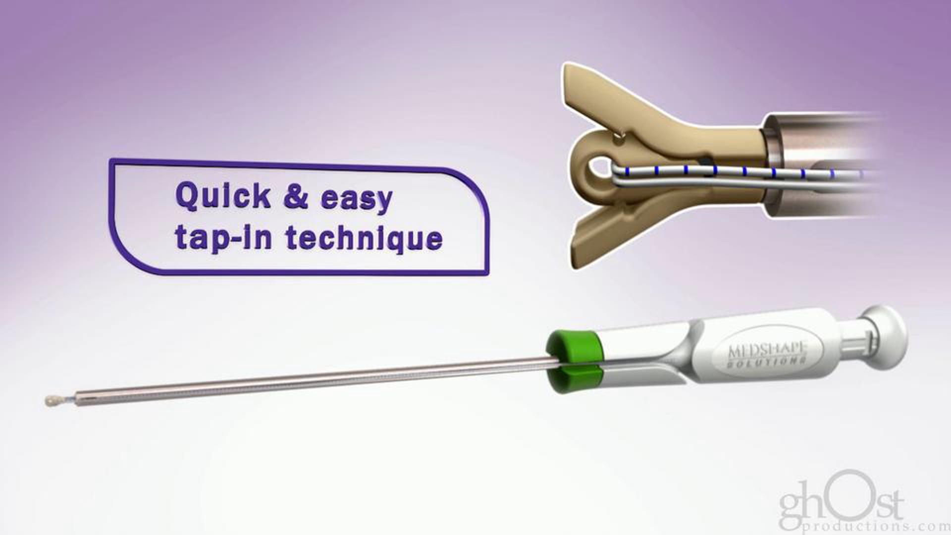 MedShape Solutions, Ghost Productions, medical device company, innovative product, MedShape Morhpix™, orthopedic surgery, customizable implant, unique anatomy, medical accuracy, attention to detail, bone growth, patient outcomes, advancements, personalized medicine.