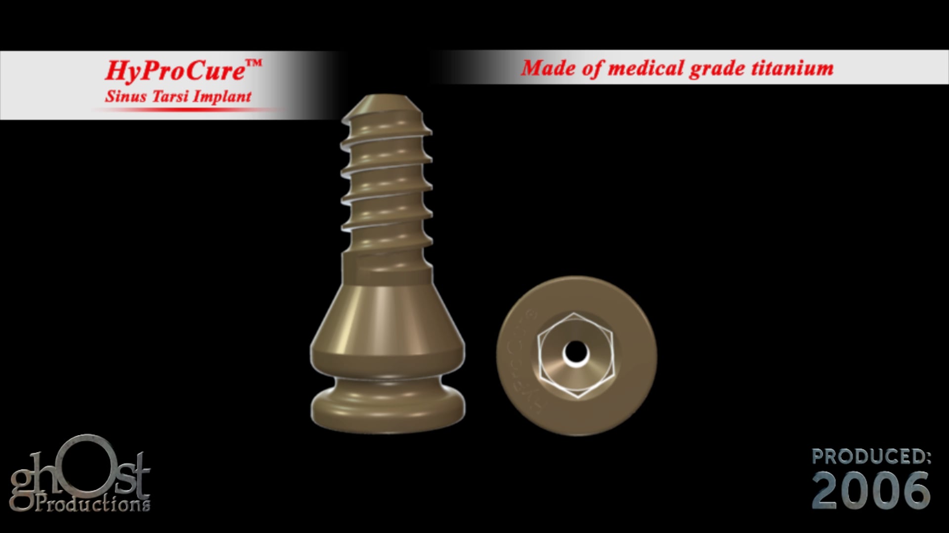 Ghost Productions, medical animation, surgical technique, HyProCure sinus tarsi implant, Hyperpronation, foot realignment, body alignment, pain reduction, healthcare professionals, patients, orthopedic medicine, medical technology, medical expertise.