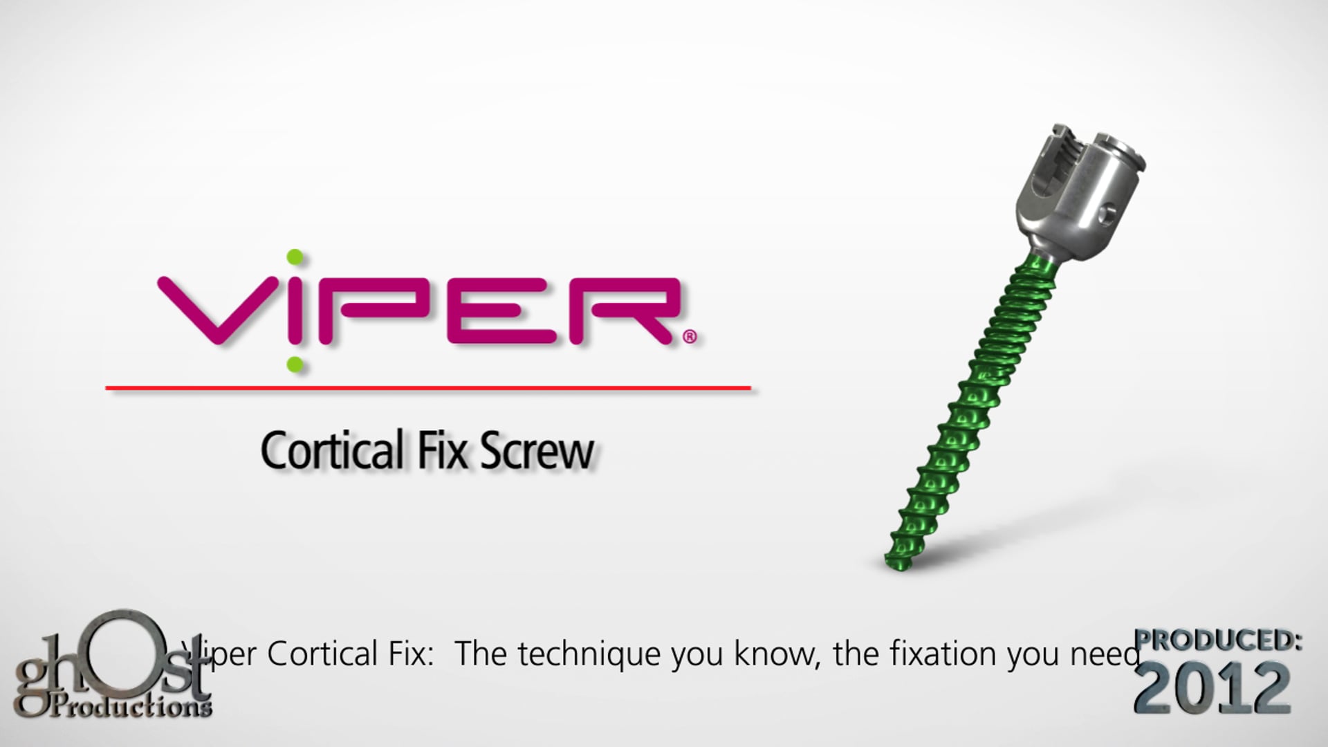medical animation, Depuy, Cortical Fixation screw, Cortical Fix thread form, pedicle, fixation, resistance to pull out, EXPEDIUM, VIPER, spine systems, spinal surgery, medically accurate, visually engaging, cutting-edge product, patient outcomes, spinal medicine.