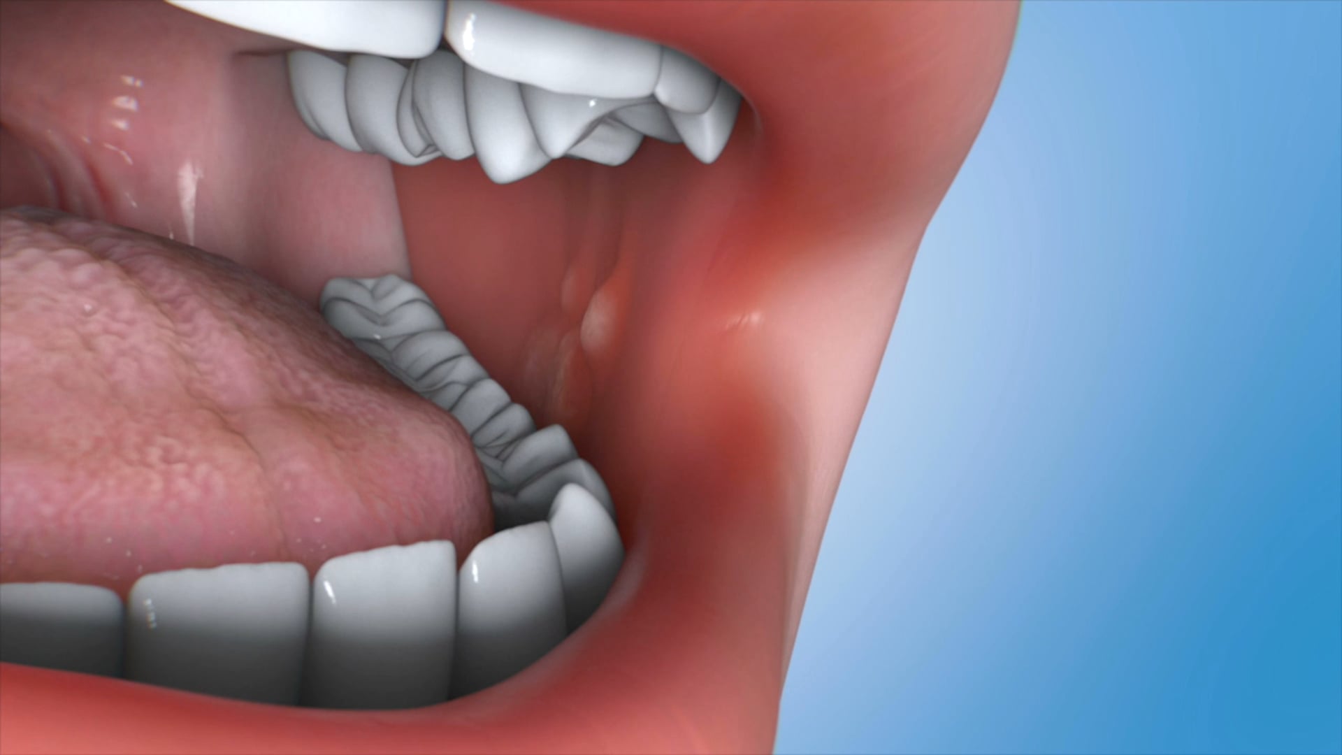 Ghost Medical's Oral Cancer Detection for Dental Professionals