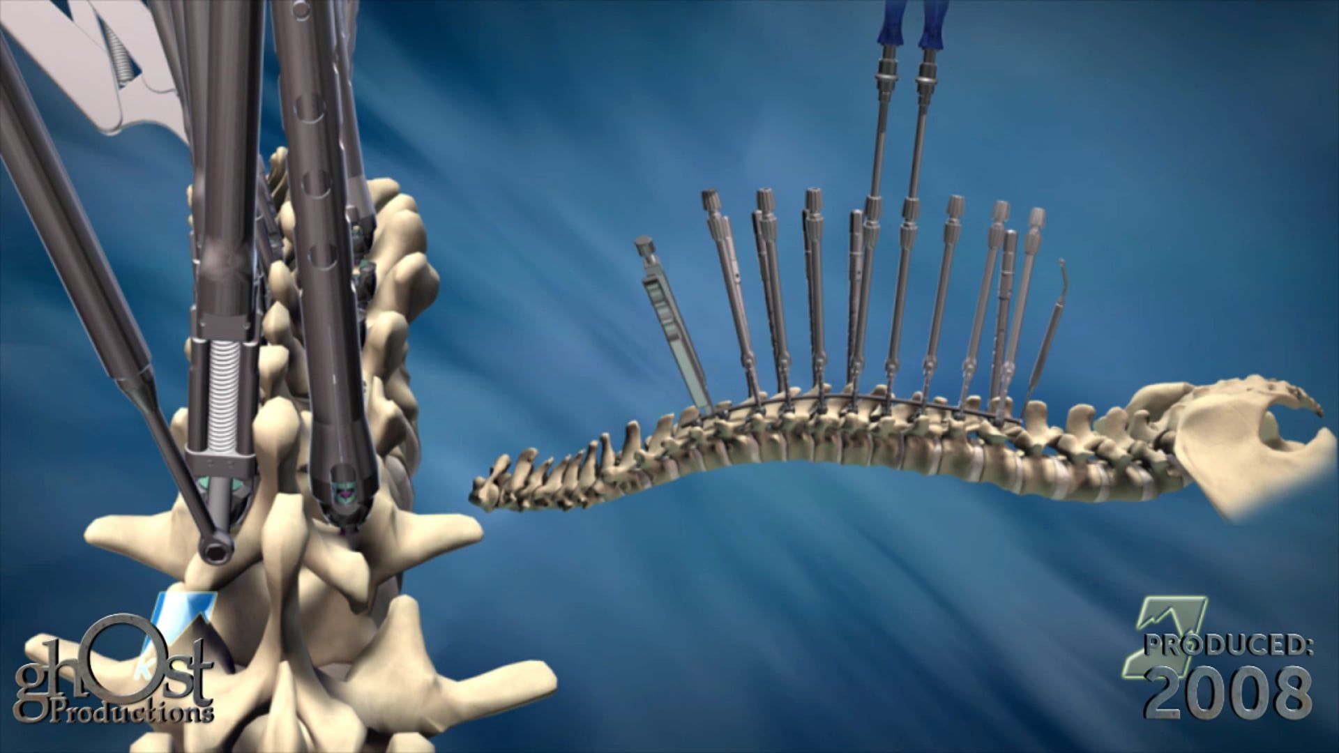 Ghost Medical Presents: K2M 2008NASS Animation