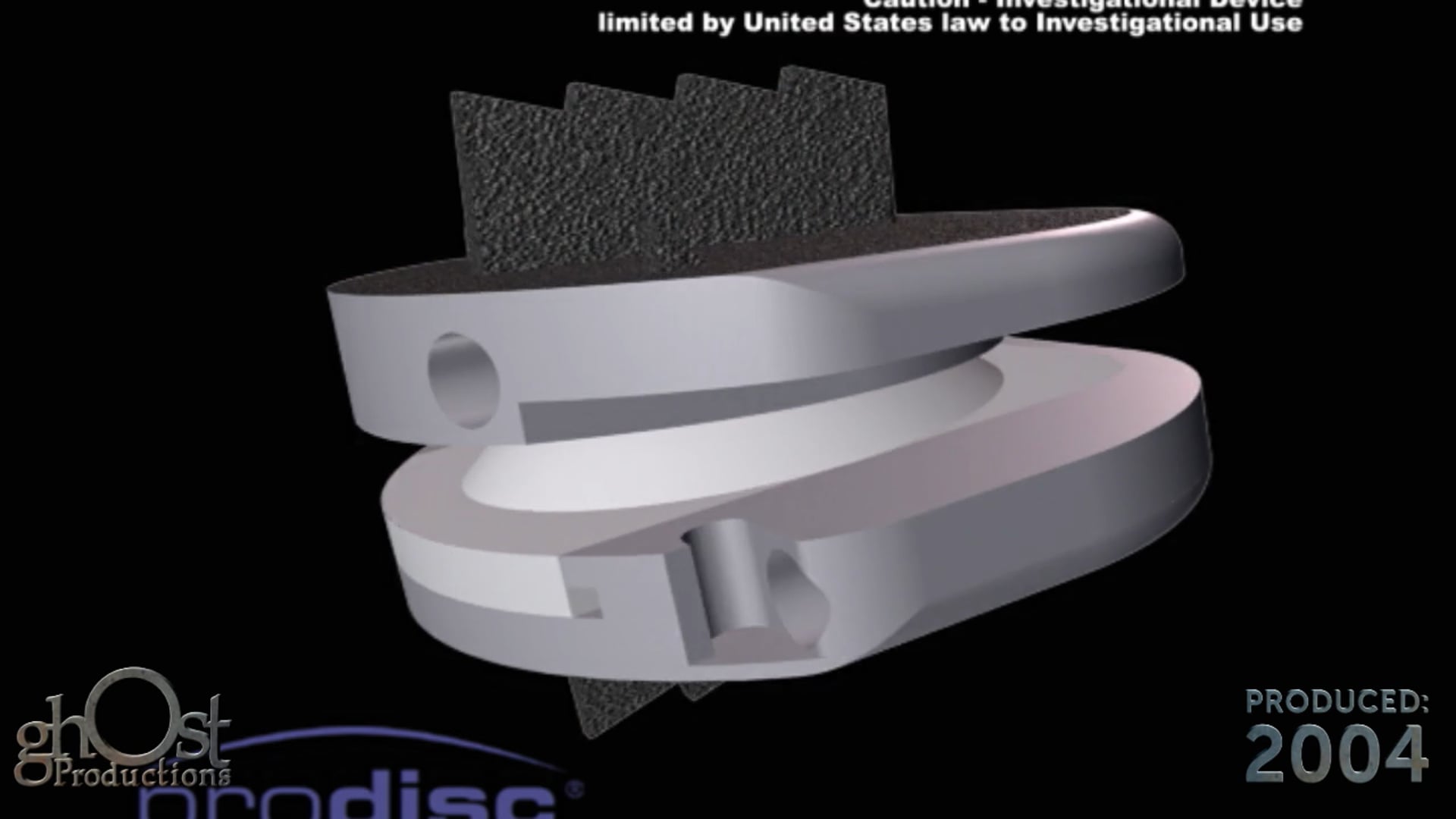 ProDisc, motion preservation, spinal implant, procedure, step-by-step, degenerative disc disease, animation, medical accuracy, pain relief, orthopedic surgery, spinal health, patient education, medical professional education, ProDisc product, innovative, patient outcomes.