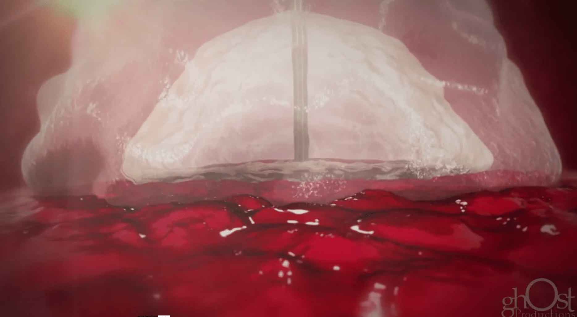 Cardinal Health, MynxAce, Vascular Closure Device, femoral artery, diagnostic procedures, interventional procedures, manual compression methods, healthcare professionals, patients, safe, effective, advanced technology, user-friendly design, superior alternative, risk of complications, faster recovery time, medical specialties, cardiology, interventional radiology, vascular surgery, endovascular surgery, interventional cardiology, interventional neurology, interventional nephrology, interventional pulmonology, interventional gastroenterology, interventional oncology, interventional pain management.