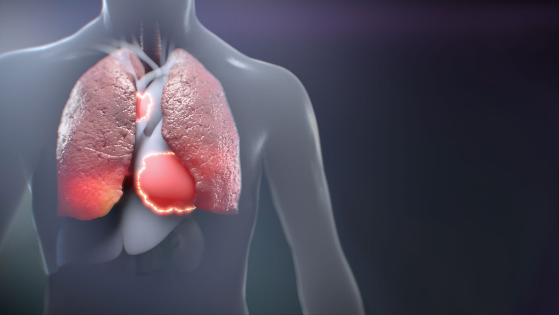 COVID-19, PSA animation, Ghost Productions, virus transmission, prevention measures, public education, virus overview, protection, medical animation, VR surgery, infectious diseases, respiratory illnesses, public health, epidemiology, immunology, virology, pulmonology, infectious disease specialists, respiratory therapists, public health officials, healthcare providers, medical educators