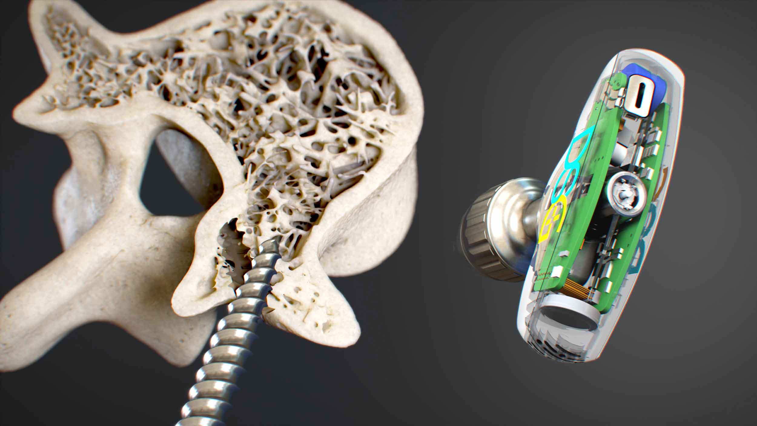 A medical device illustration displaying intricate design and functionality. Valuable resource for medical education and training. High-quality resolution and attention to detail. Essential addition to any medical image database.