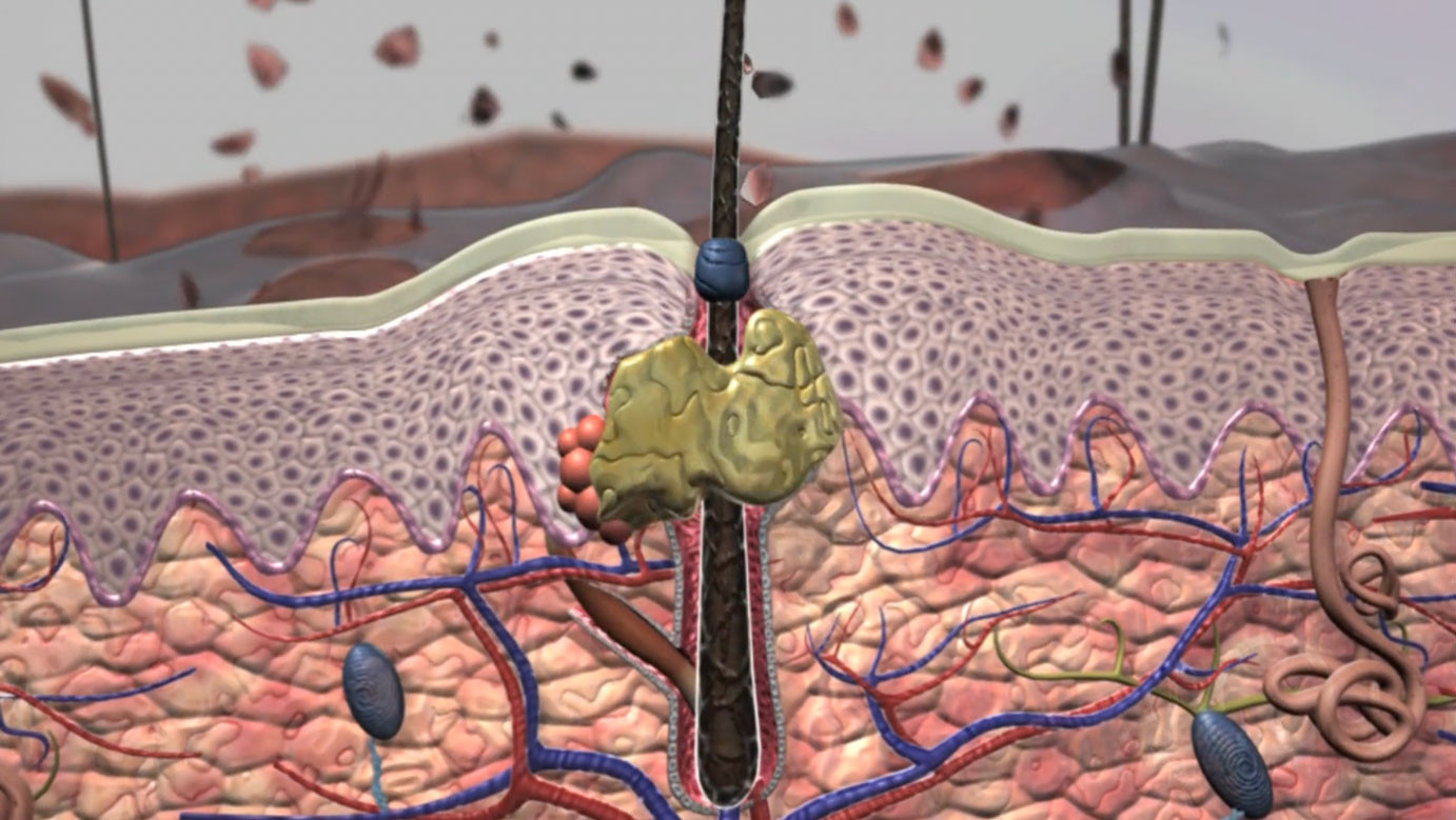 pimples, skin issues, dermatology, acne, skincare, inflammation, redness, expert tips, tricks, treatment, prevention, medical advice, Ghost Medical Animation, VR Surgery